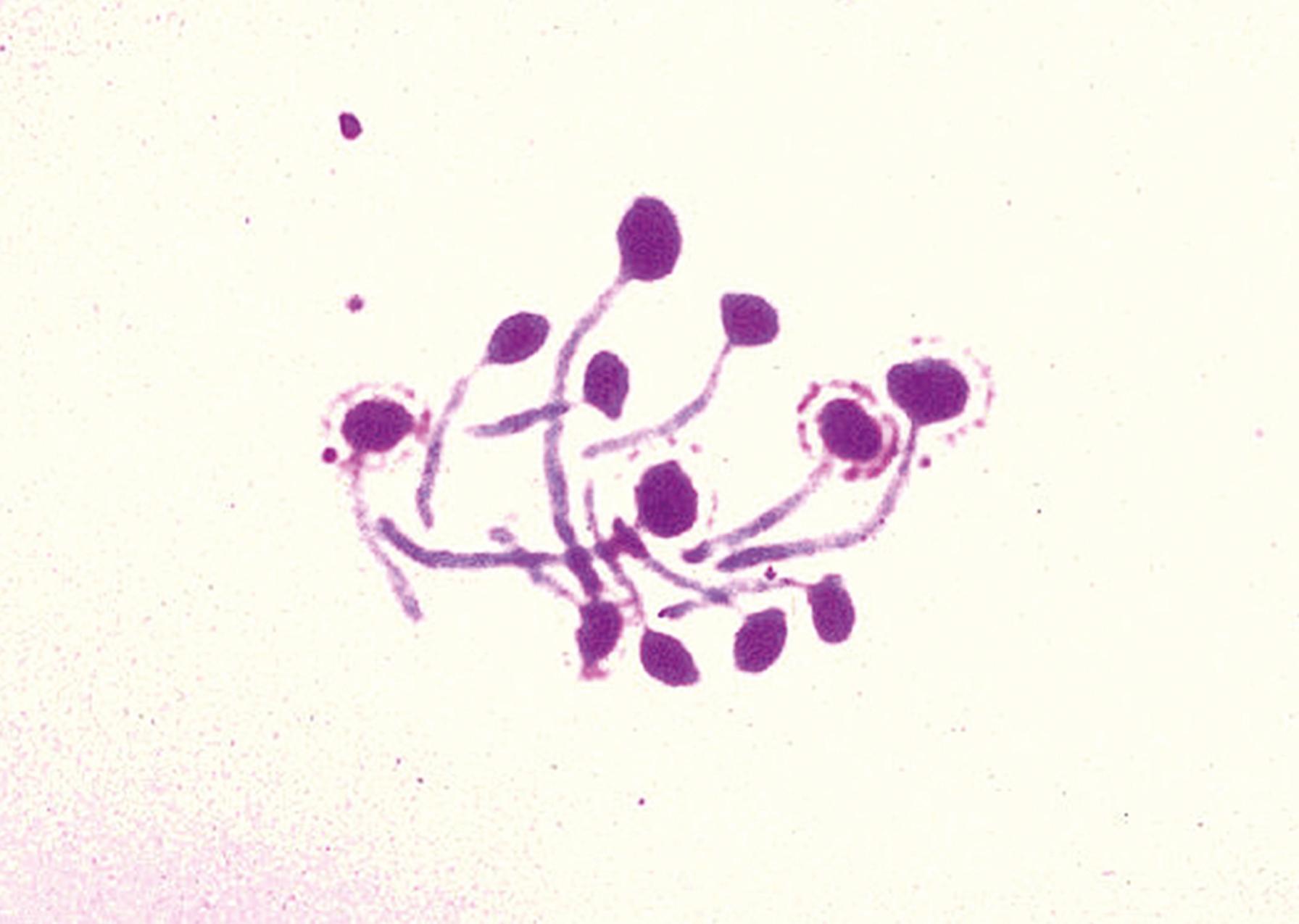 Fig. 60.16, Germ tubes have extended from the yeast cells of Candida albicans. No constriction is seen at the junction of yeast cell and germ tube. The walls of the germ tube are parallel. The yeast was incubated for 2 hours at 37°C in serum.