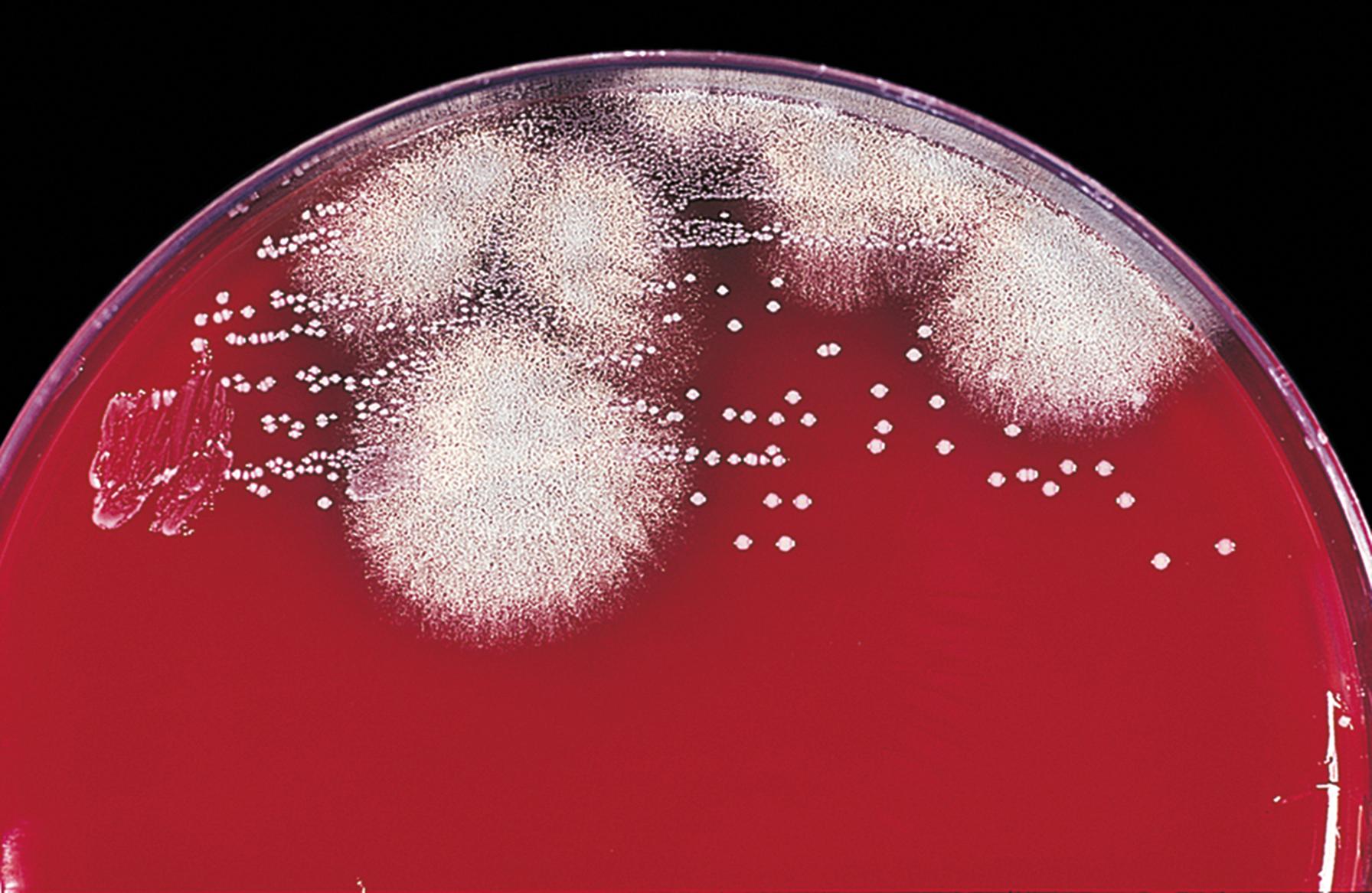 Fig. 60.2, Powdery surface of the colonies of Aspergillus fumigatus overlies white masses of mycelium. Adjacent bacterial colonies contrast with the filamentous fungus.