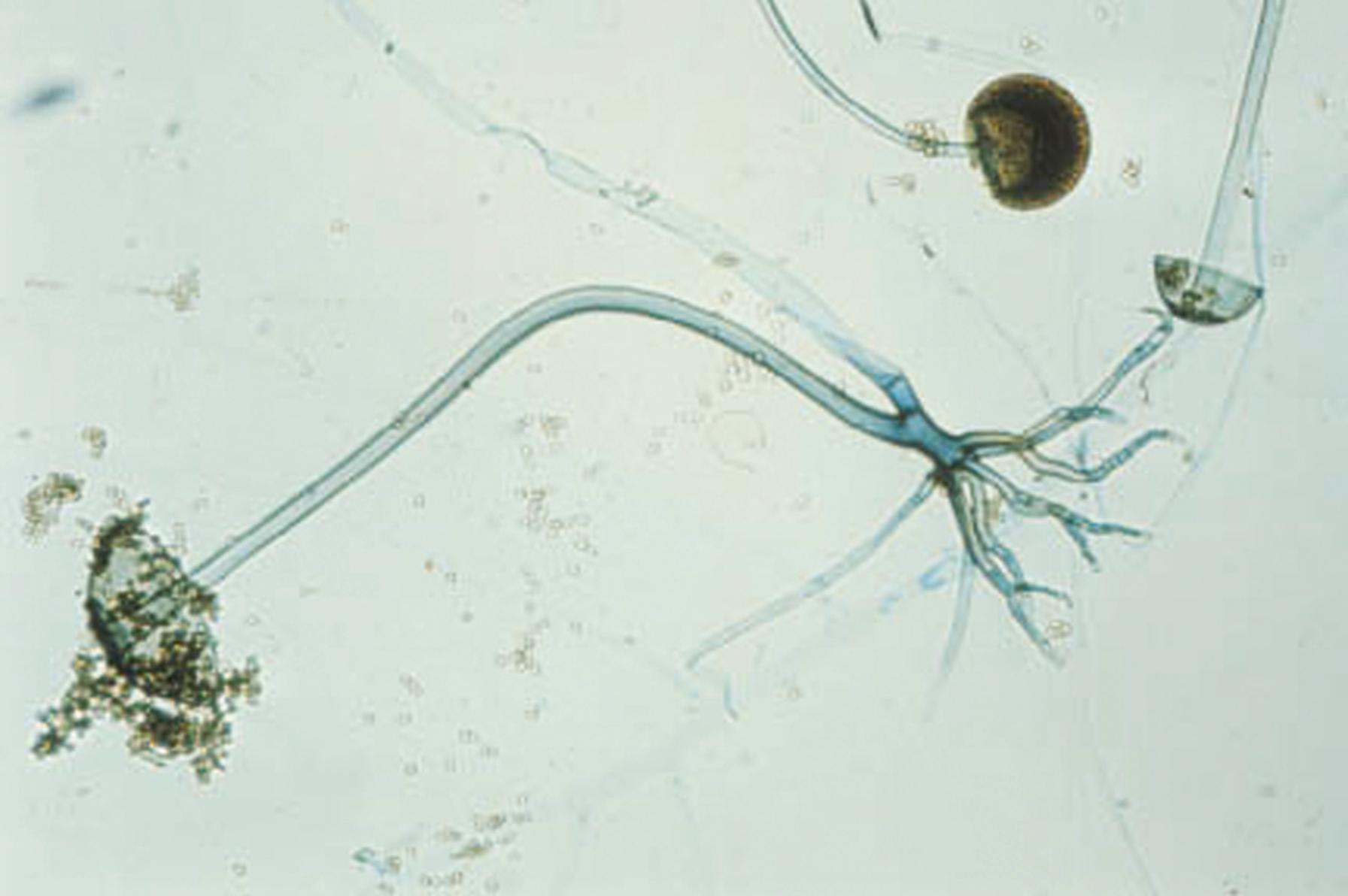 Fig. 60.6, Sporangiophores of Rhizopus spp. supporting sporangia that contain sporangiospores. Rhizoids arise from the hyphae near the origin of the sporangiophores.