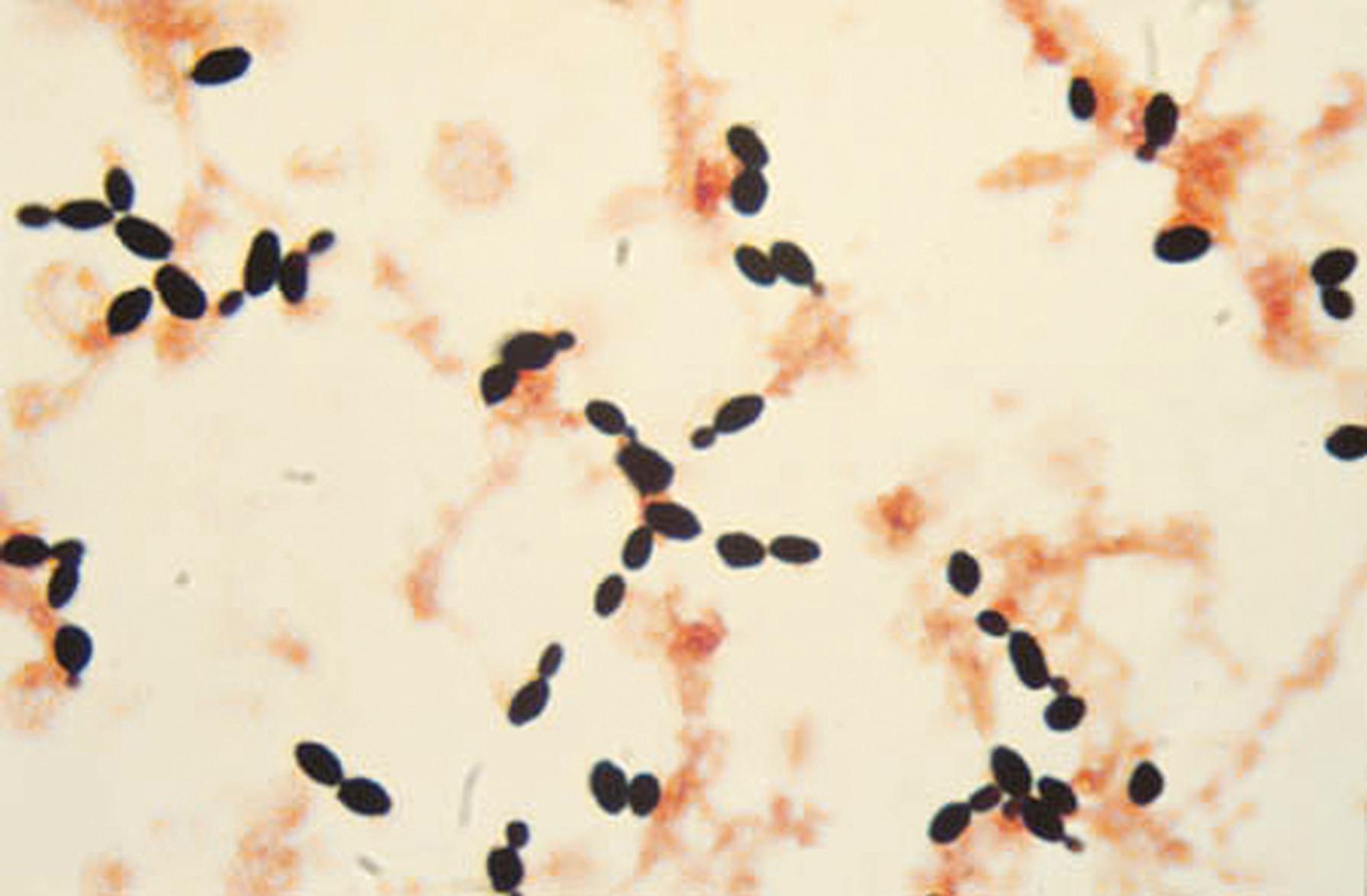 Fig. 60.7, Budding and nonbudding yeast cells detected in a blood culture bottle sample.