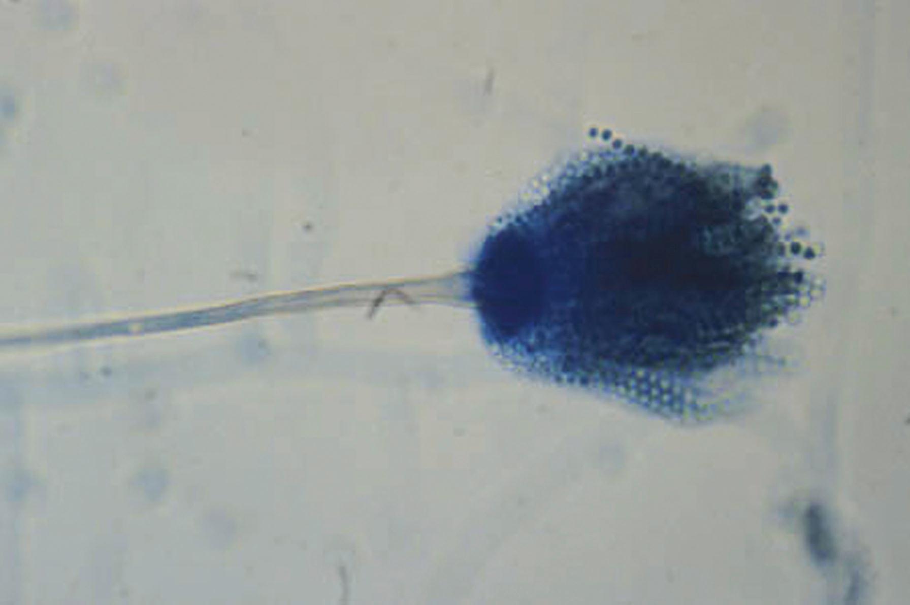 Fig. 60.8, Fruiting head of Aspergillus fumigatus . The conidiophore is swollen at the tip to form a vesicle, and phialides arise from the upper half of the vesicle with chains of conidia present that align parallel to the long axis of the conidiophore.