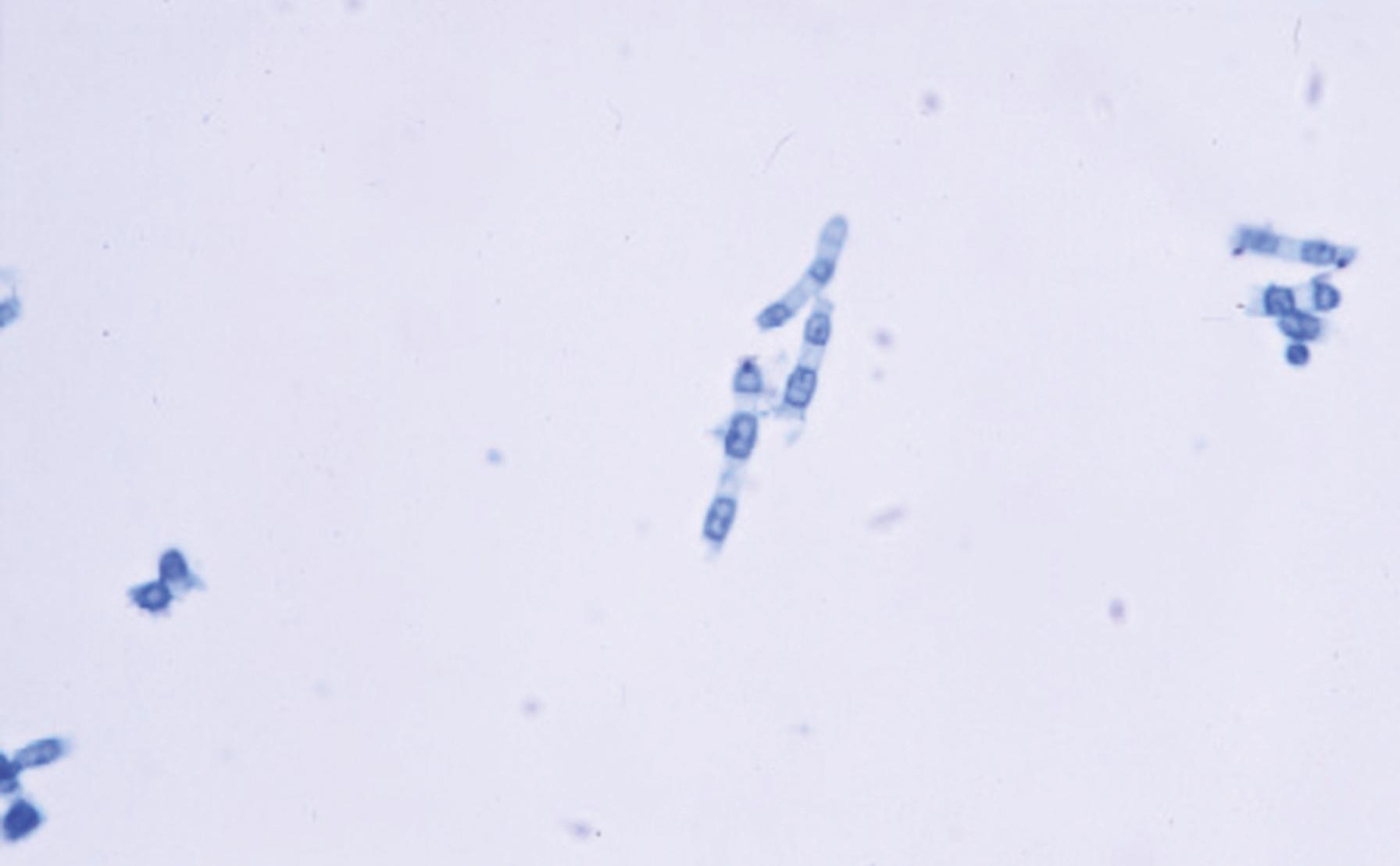 Fig. 60.9, Arthroconidia of Coccidioides spp. Alternating barrel-shaped arthroconidia are separated by thin-walled, empty disjunctor cells within portions of the hyphae.