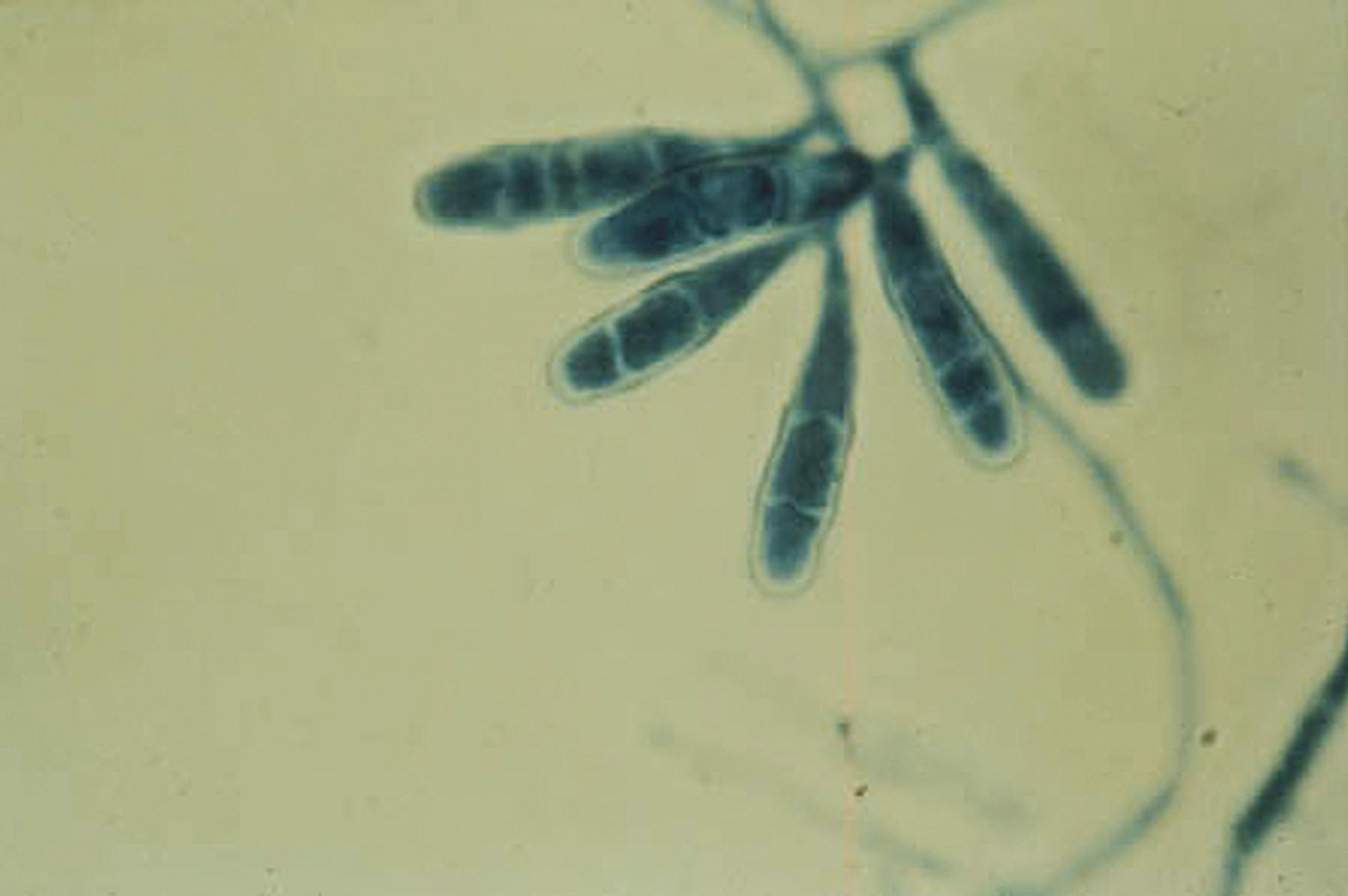 Fig. 60.10, Macroconidia of Epidermophyton floccosum. Typical blunt-ended macroconidia occur in aggregates along the hyphae with the absence of microconidia.