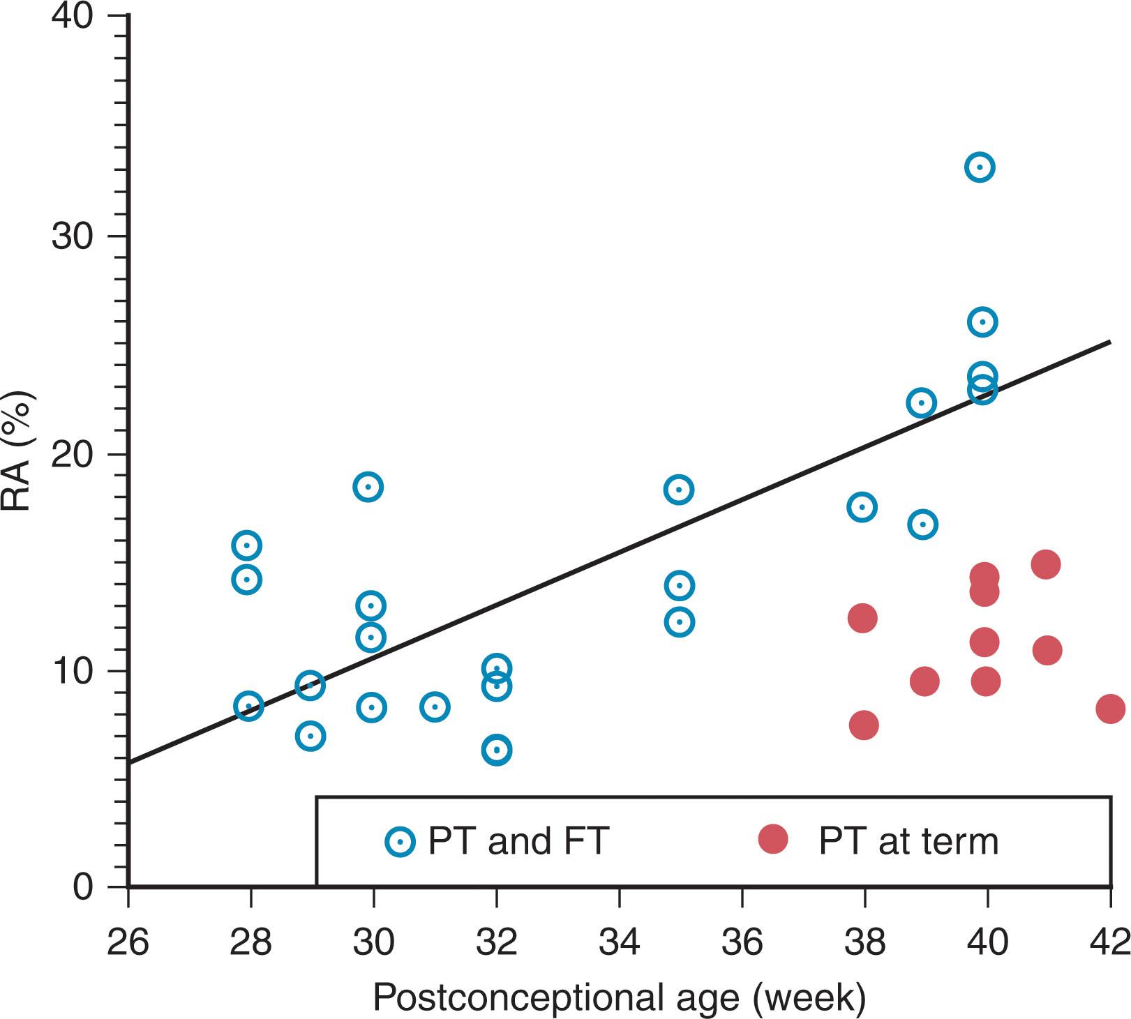 Fig. 8.4, Diffusion tensor MR determination of relative anisotropy (RA) in cerebral white matter of normal preterm (PT) and term (FT) infants (open circles) as a function of postconceptional age. Note the striking increase in RA, indicative of increasing directionality of diffusion, perhaps related at least in part to oligodendroglial ensheathment of axons, with maturation. The lower values of the preterm infants studied at term ( closed circles ) suggest a deleterious effect of prematurity on this process (see text for details).