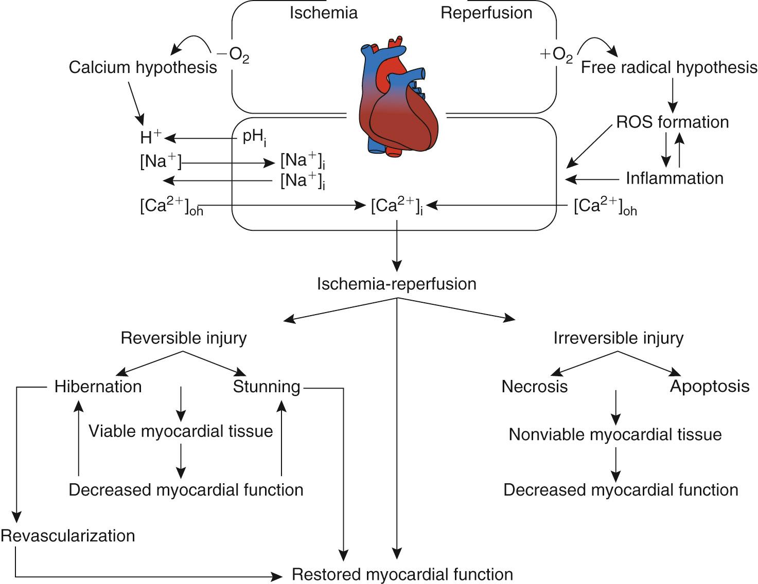 FIGURE 65-3, Mechanisms of ischemia-reperfusion injury. Putative mechanisms of the calcium and free radical hypotheses and inflammation in the generation of ischemia-reperfusion injury. ROS, Reactive oxygen species.