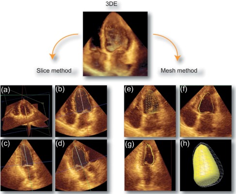 Figure 10.12, Examples of three-dimensional echocardiographic analysis using mesh and slices. Volumes can be obtained from three-dimensional echocardiographic (3DE) datasets by one of two methods. With the first, equally spaced slices are traced in end-systole and end-diastole and combined to obtain volumes (three traced slices are shown in a–d). The second method uses automated software to generate a 3D mesh from points identified on the four- and two-chamber views (e–h).