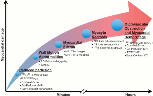 Figure 10.5, Pathophysiology of the ischemic cascade and what imaging techniques detect in acute myocardial infarction. The first process to occur is acute reduction of myocardial perfusion; this can be depicted by nuclear imaging, MR, CT, or contrast echo. Reduction of wall motion follows rapidly and can be detected by echo or cine CMR. Myocardial edema is the last reversible stage in ischemic cascade and can be identified by T2 or T1 CMR. With the progressive increase of duration, myocyte death occurs. This can be detected by late Gd and contrast-enhanced CT, and by indium antimyosine imaging. Destruction of the microvasculature and intramyocardial hemorrhage marks the most severe stage of necrosis and can be detected by nuclear perfusion imaging, contrast echo, MR, or CT.