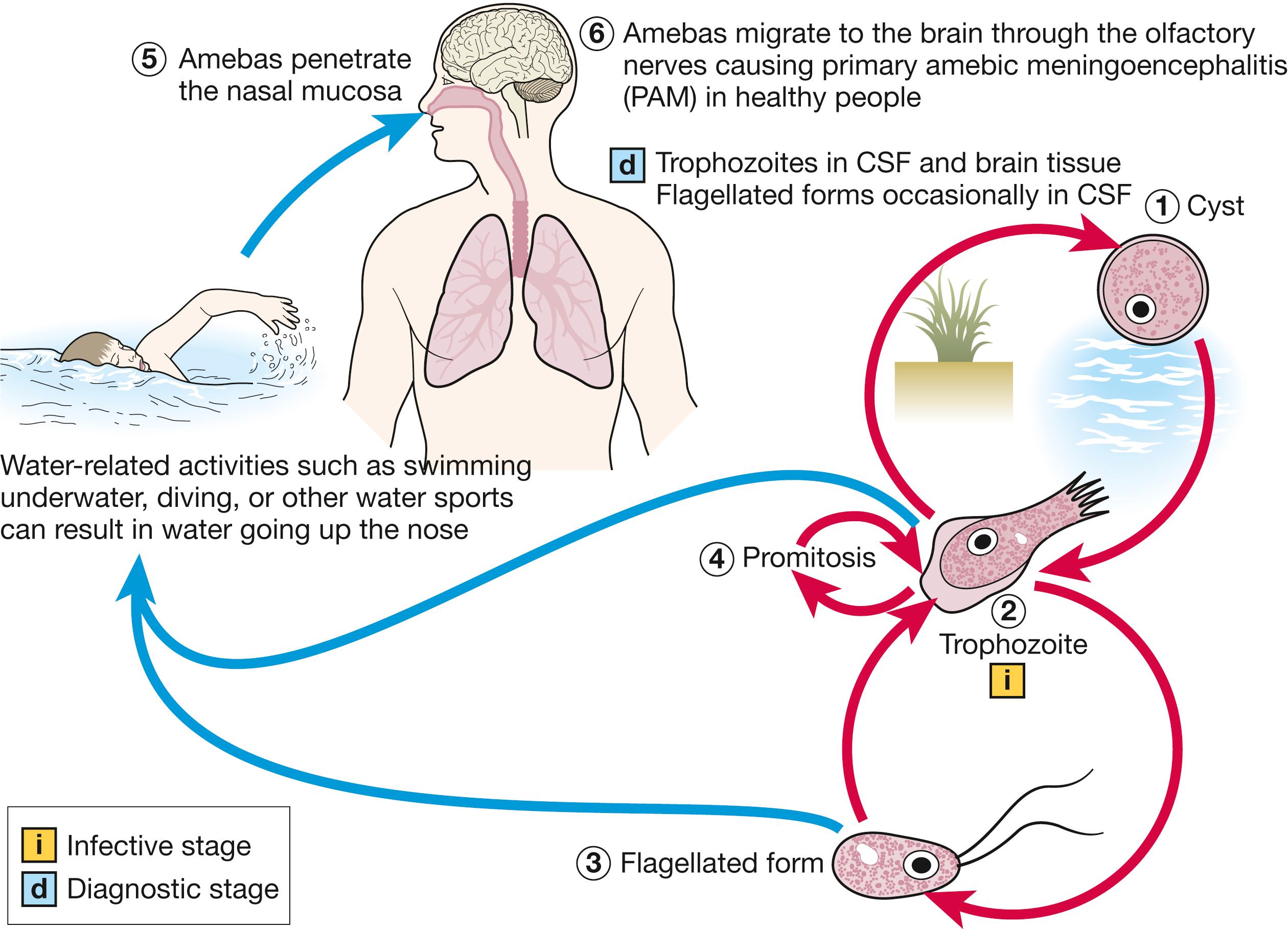 FIGURE 269.1, Life cycle of Naegleria fowleri. Naegleria fowleri has 3 stages in its life cycle: ( 1 ) cysts, ( 2 ) trophozoites, and ( 3 ) flagellated forms. The trophozoites replicate by ( 4 ) promitosis (nuclear membrane remains intact). N. fowleri is found in freshwater, soil, thermal discharges of power plants, heated swimming pools, hydrotherapy and medicinal pools, aquariums, and sewage. Trophozoites can turn into temporary non-feeding flagellated forms, which usually revert back to the trophozoite stage. Trophozoites infect humans or animals by ( 5 ) penetrating the nasal mucosa and ( 6 ) migrating to the brain through the olfactory nerves, thus causing primary amebic meningoencephalitis. N. fowleri trophozoites are found in cerebrospinal fluid and tissue, whereas flagellated forms occasionally are found in cerebrospinal fluid. Cysts are not seen in brain tissue.