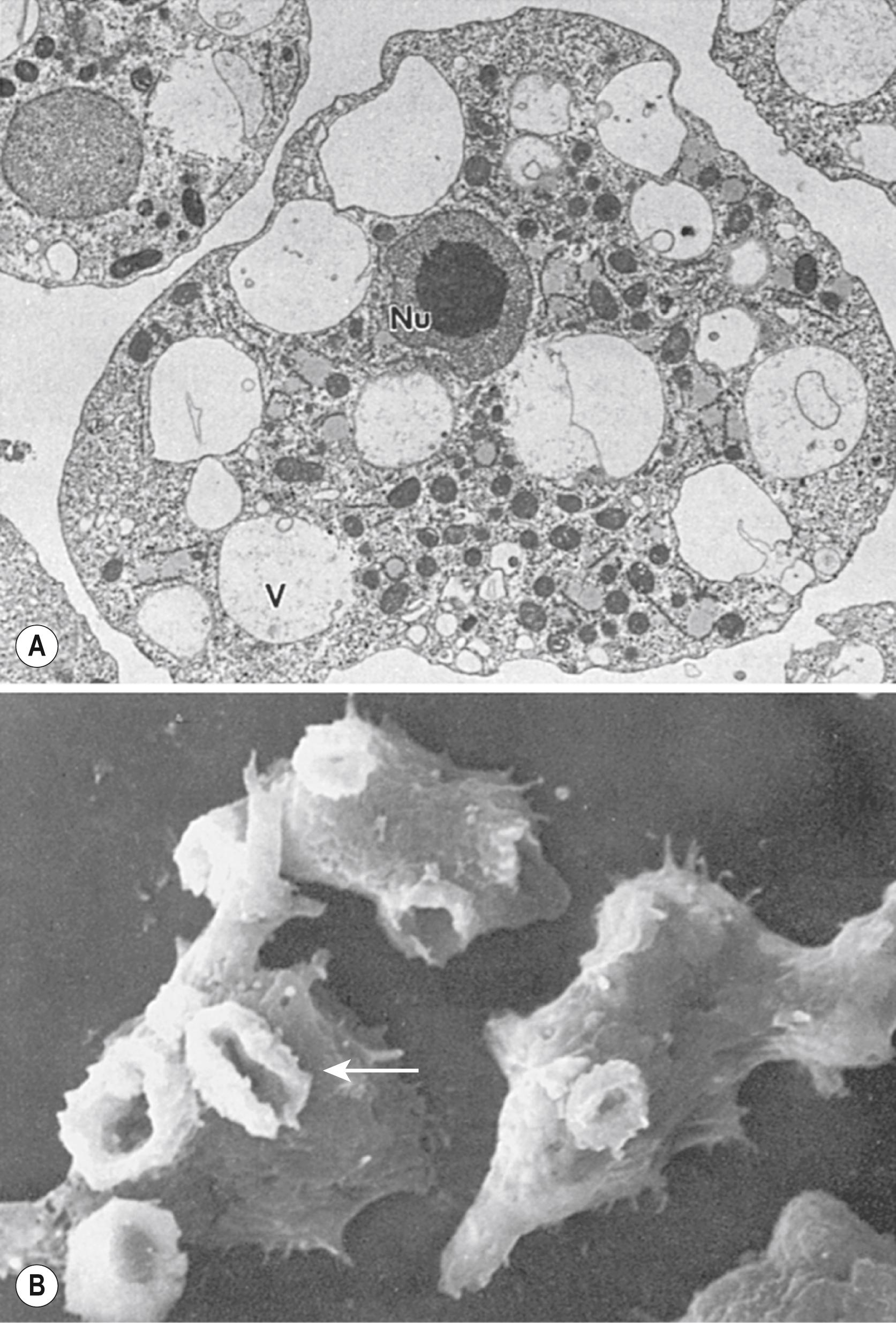 FIGURE 269.2, (A) Transmission and (B) scanning electron micrographs of Naegleria fowleri. Trophozoites of a pathogenic N. fowleri (LEE strain) ameba, isolated from a human case of primary amebic meningoencephalitis in 1968, were grown axenically in Cline medium at 37°C. Food-cup surface structures (arrow in B) are abundant on the surface of the amebae. These structures are used to ingest bacteria, yeast, or mammalian cells. Nu, nucleus; V, vacuole.