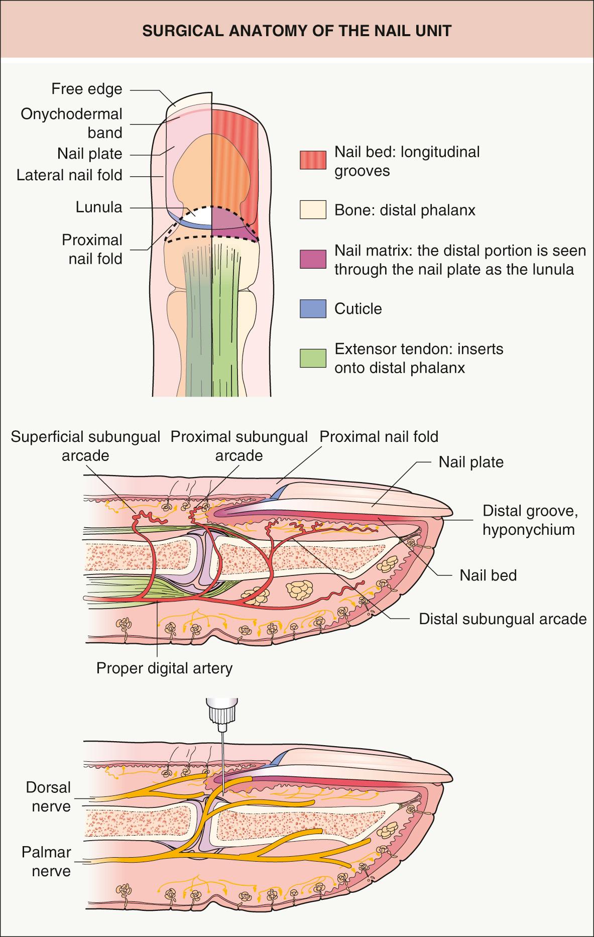 Fig. 149.1, Surgical anatomy of the nail unit.