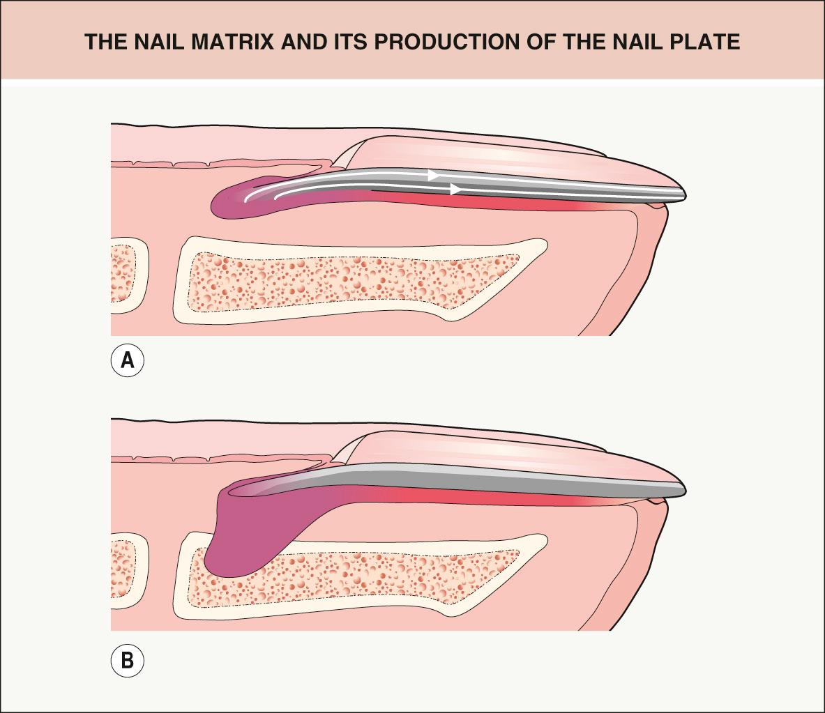 Fig. 149.2, The nail matrix and its production of the nail plate.