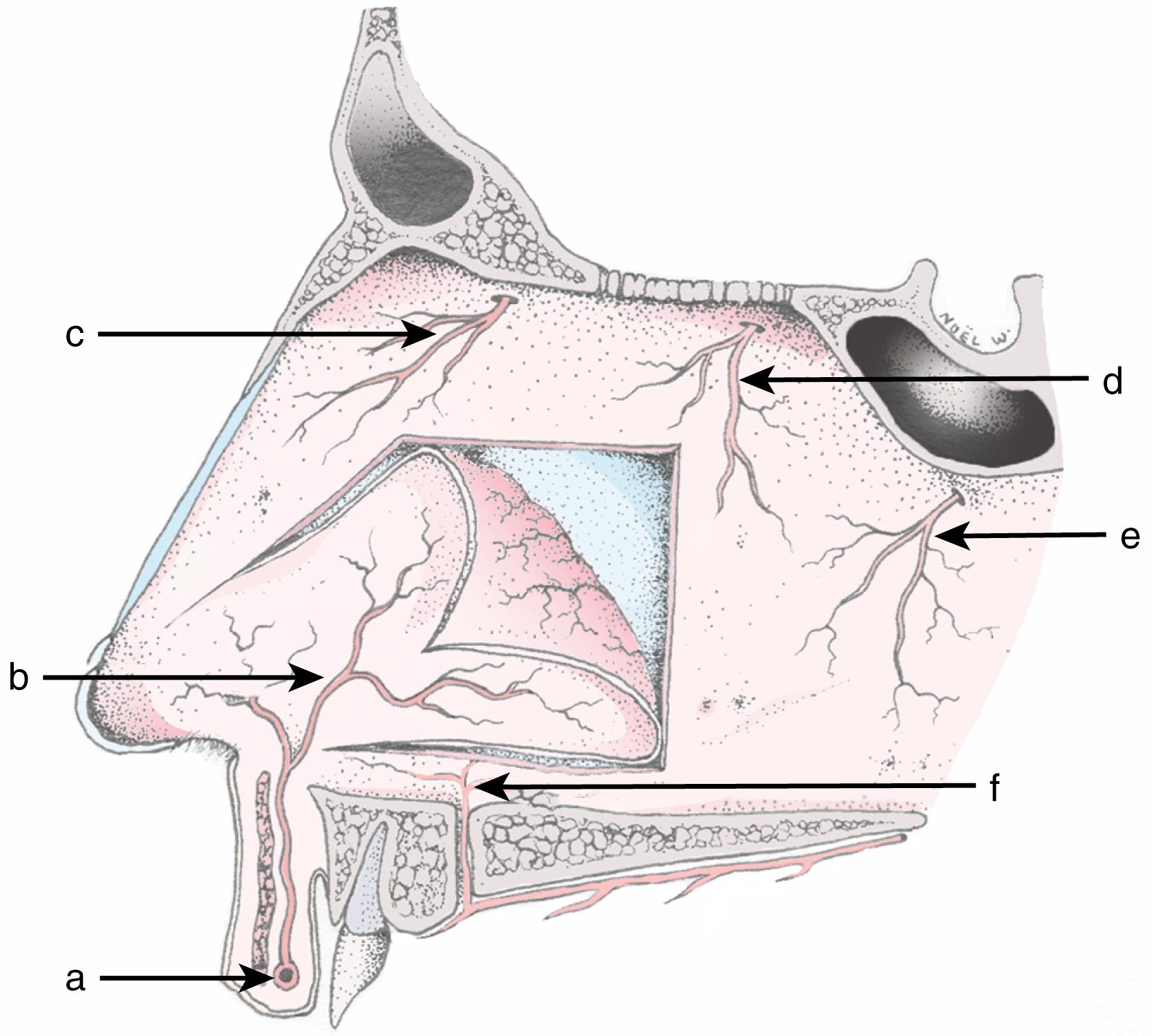 Fig. 30.1, Demonstration of the vascular supply of the nose: a , superior labial artery; b , anterior septal branch of superior labial artery; c , medical internal nasal branch of anterior ethmoid artery; d , septal branch of posterior ethmoid artery; e , posterior septal branch of sphenopalatine artery; f , branch of the greater palatine artery.