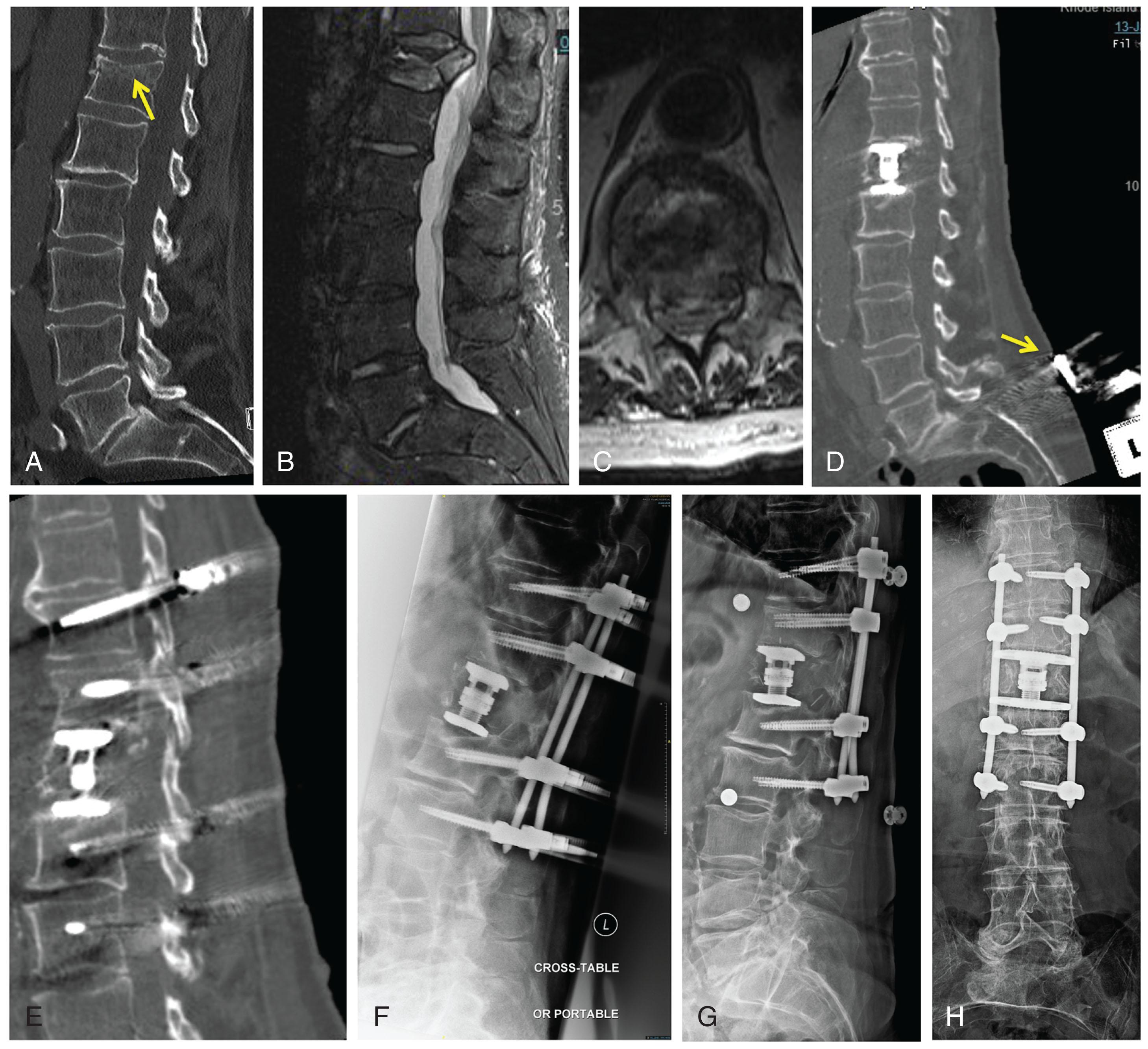 Fig. 3.1, An 80-year-old man who sustained a fall from standing at home