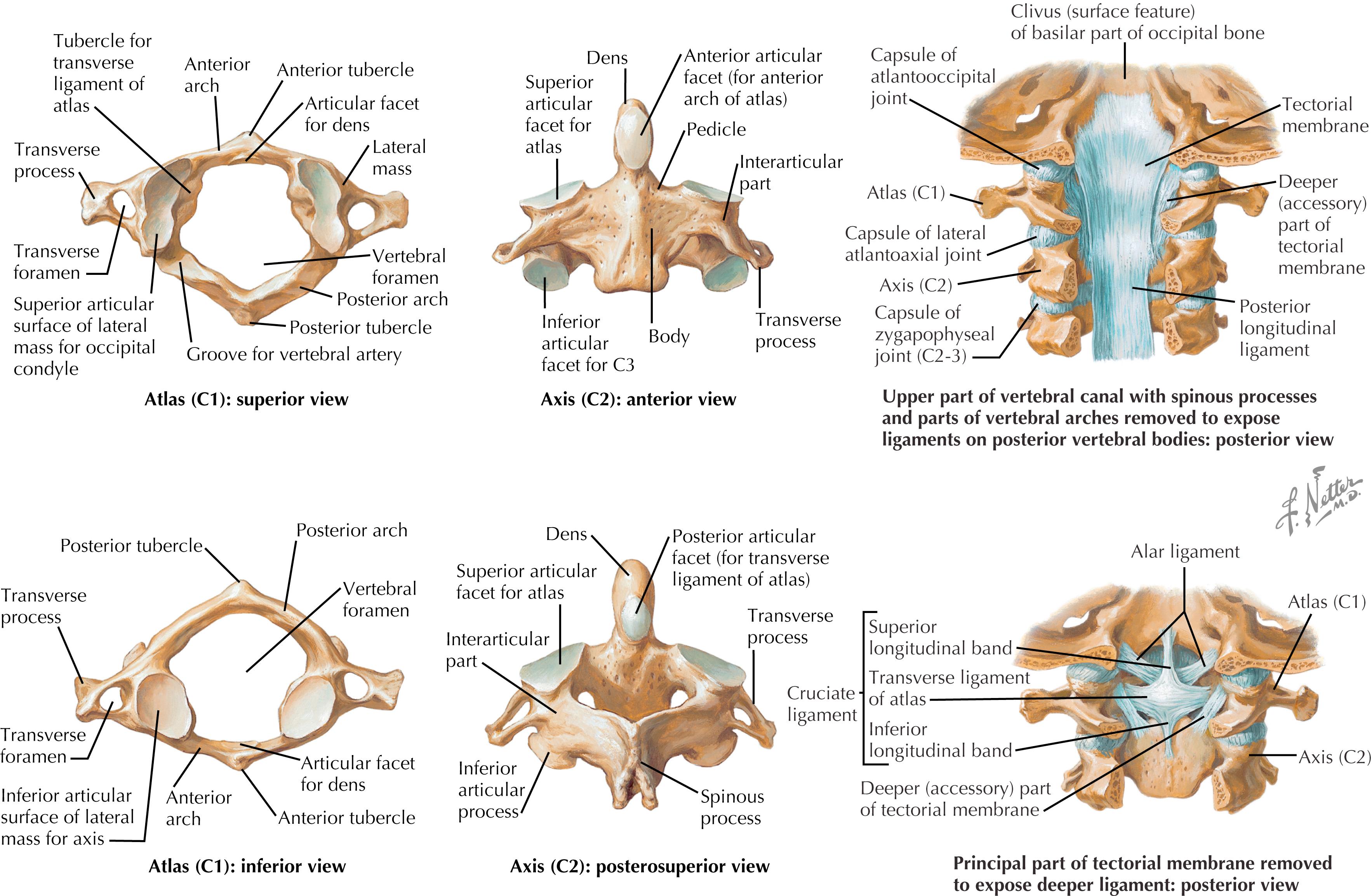 Figure 46.1, Anatomy of a vertebra.