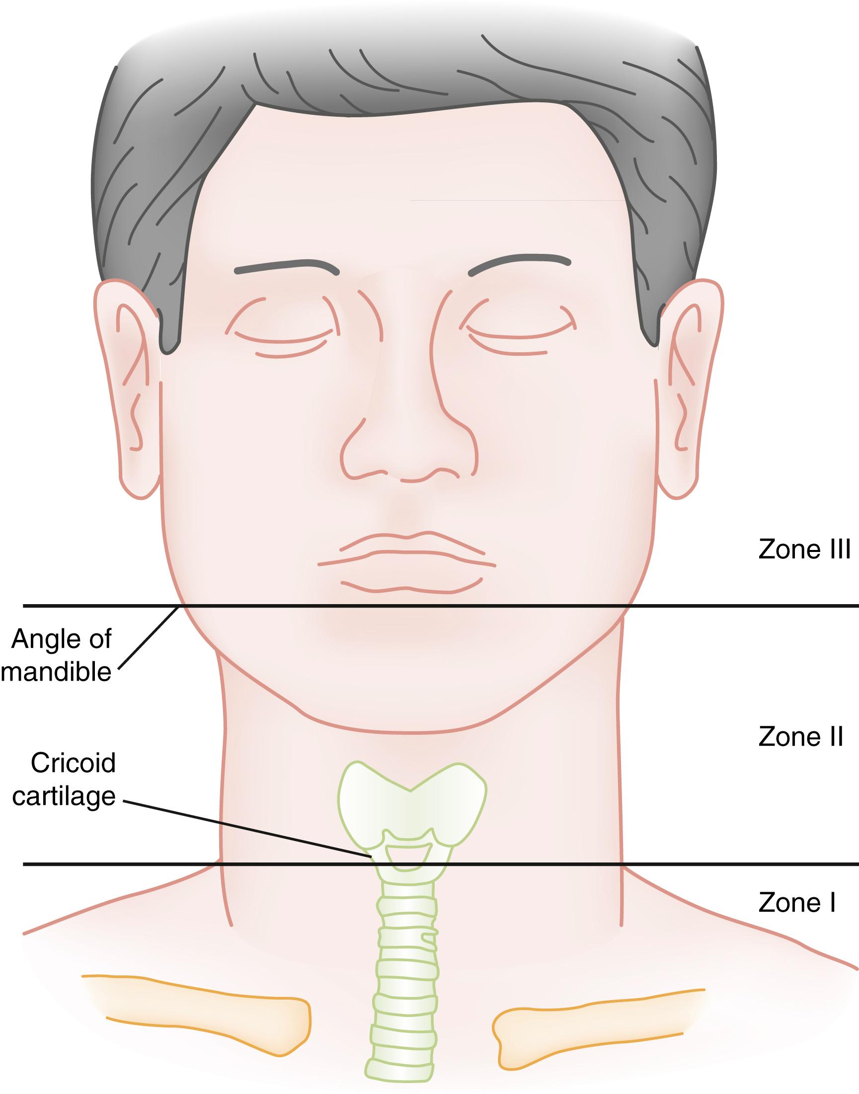 Fig. 36.1, Zones of the Neck.