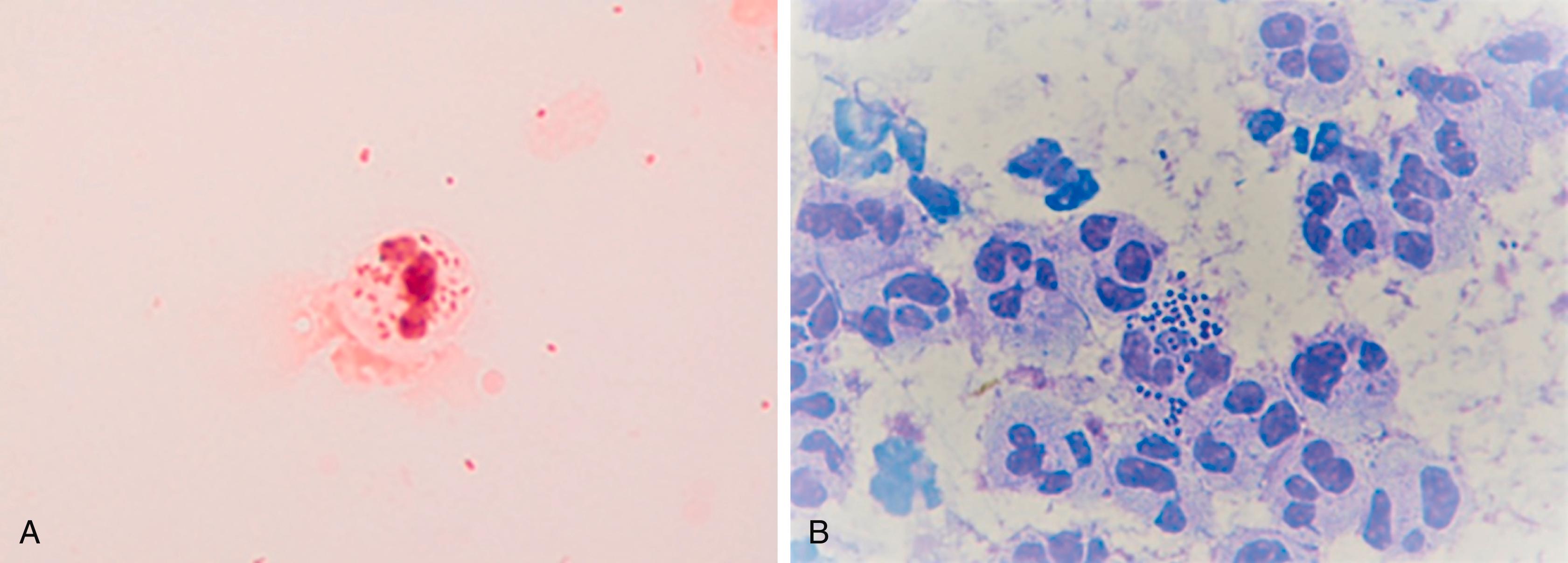 FIGURE 275-1, Stains for gonococcus. A , Gram stain.