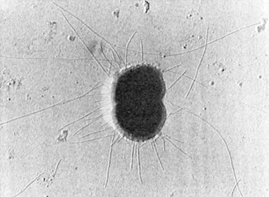 FIG. 212.2, Neisseria gonorrhoeae with numerous pili extending from the cell surface.