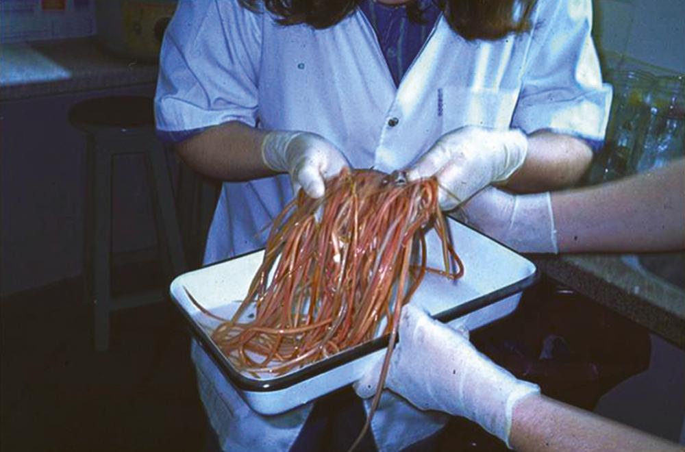 FIGURE 327-1, Mass of adult Ascaris lumbricoides worms recovered from a child after the administration of mebendazole.