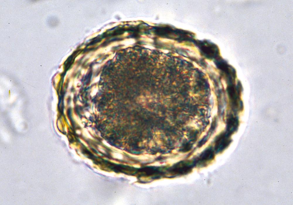 FIGURE 327-2, Fertilized, unembryonated egg of Ascaris lumbricoides .