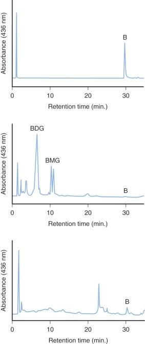 Figure 4-5, Bile pigment excretion in the adult human as assessed by high-performance liquid chromatography.