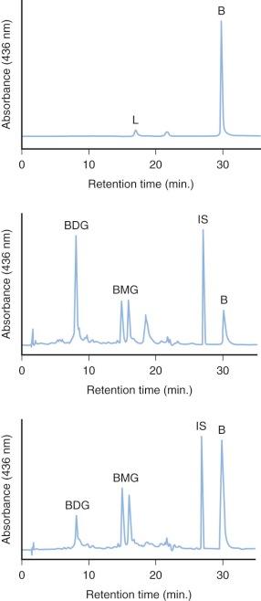 Figure 4-6, Bile pigment excretion in the newborn human as assessed by high-performance liquid chromatography.