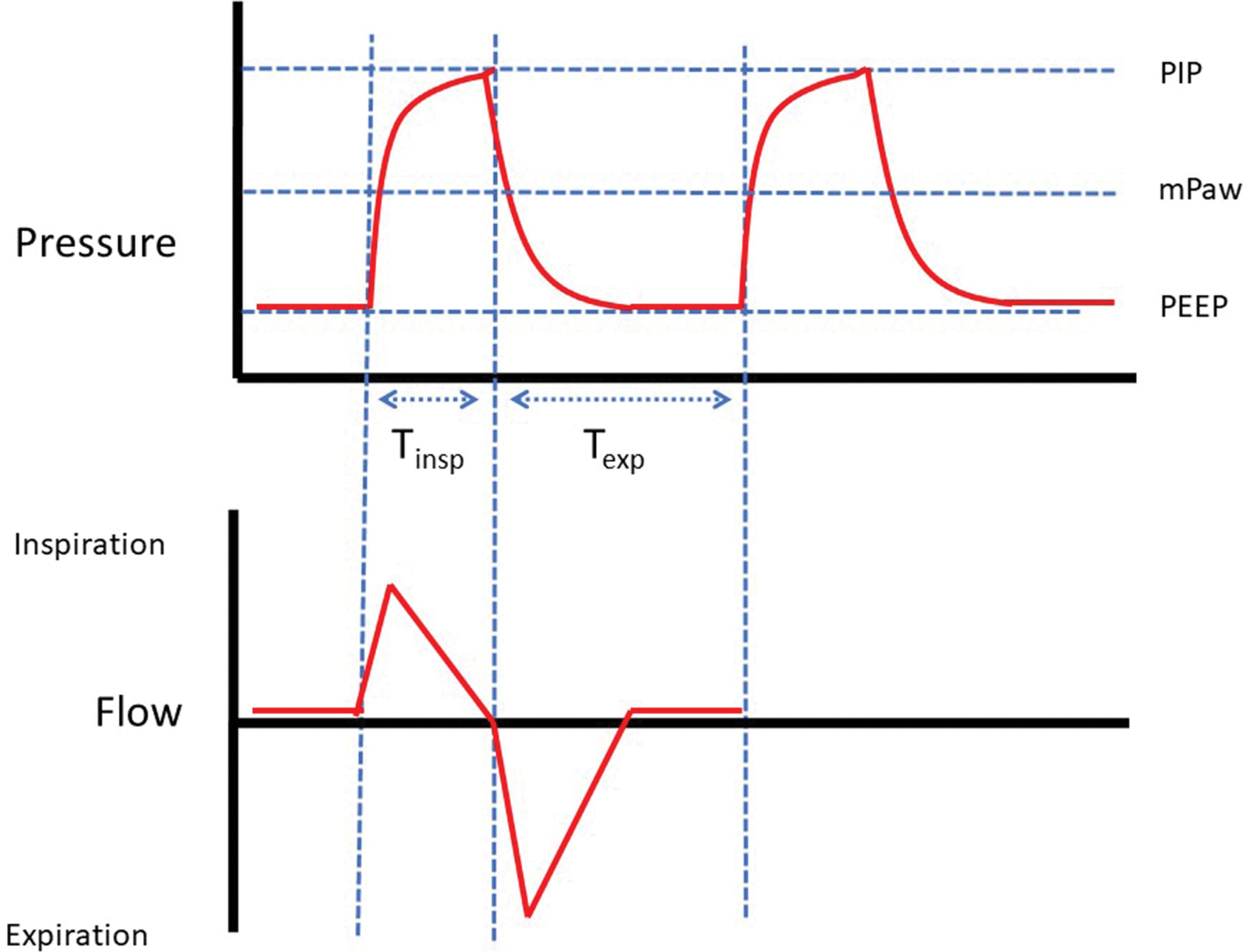 Fig. 40.1, Simplified Diagram of Pressure and Flow Versus Time With Time-Cycled Pressure-Limited (TCPL) Ventilation.