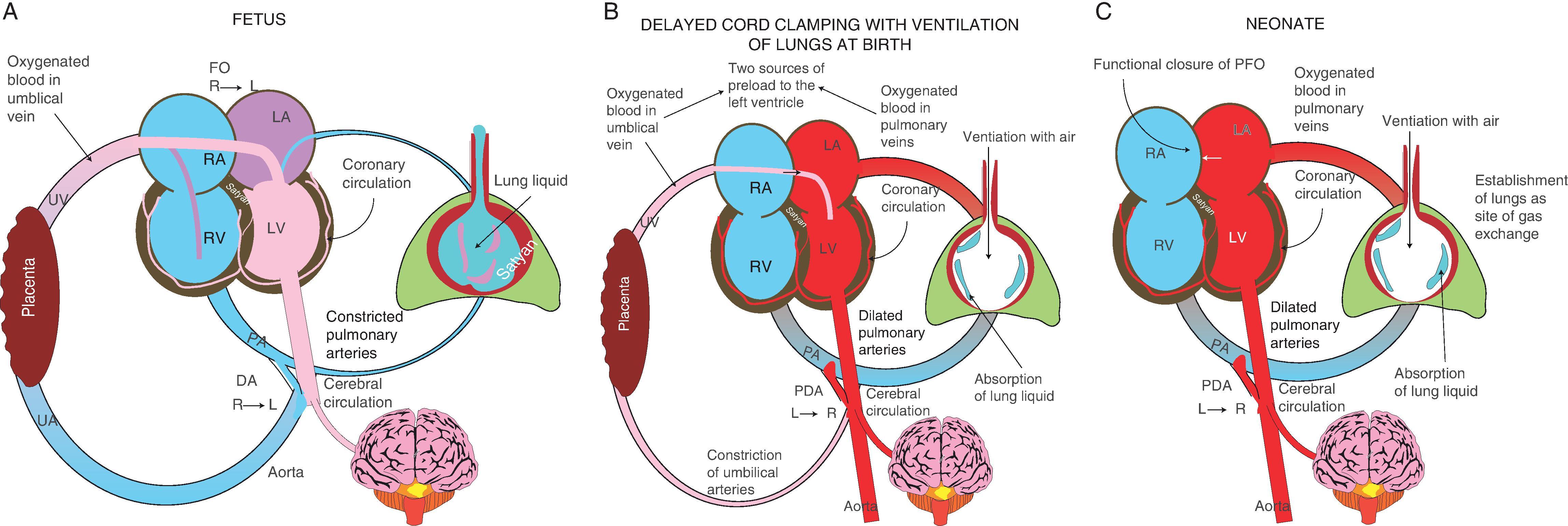 Fig. 8.1, Transition From Fetal to Neonatal Physiology .