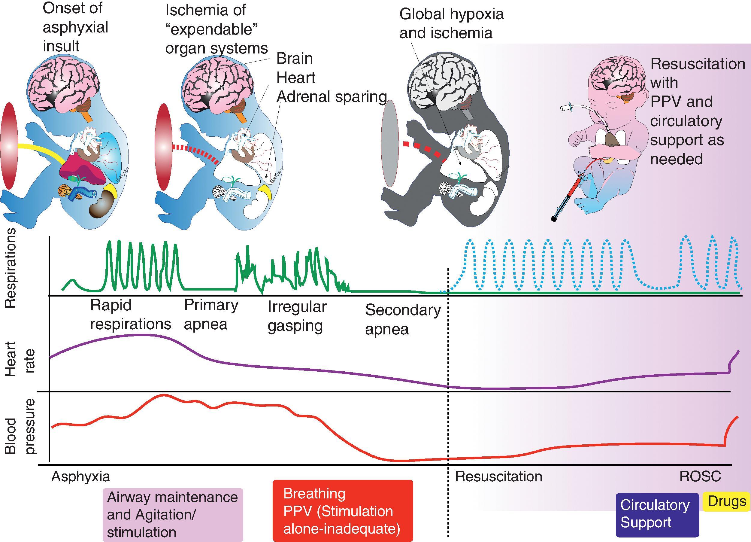 Fig. 8.2, Pathophysiology of Asphyxia and Resuscitation .