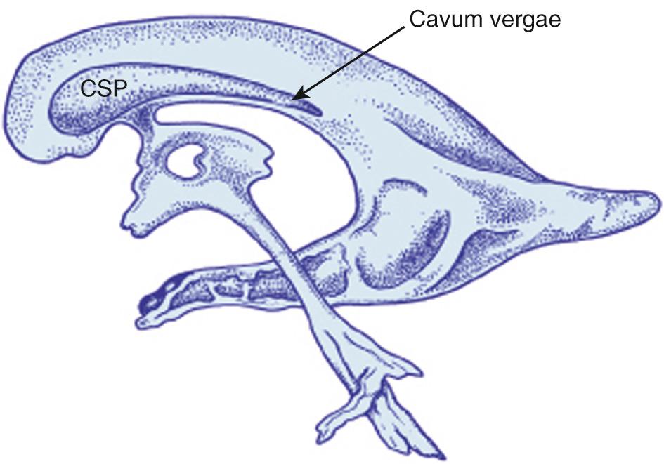 FIG. 45.13, Cavum Septi Pellucidi (CSP).