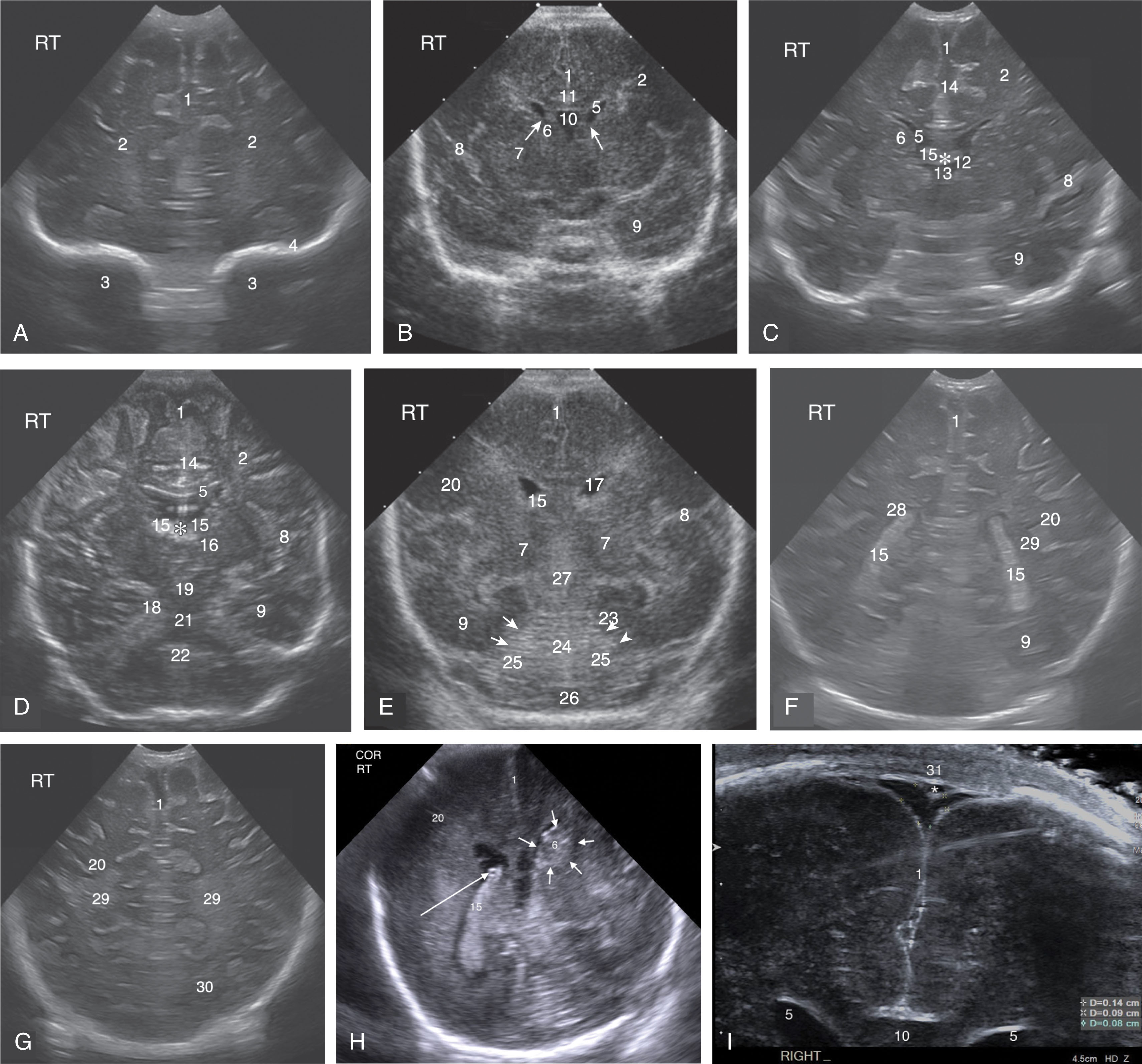 Fig. 27.15, Coronal protocol images