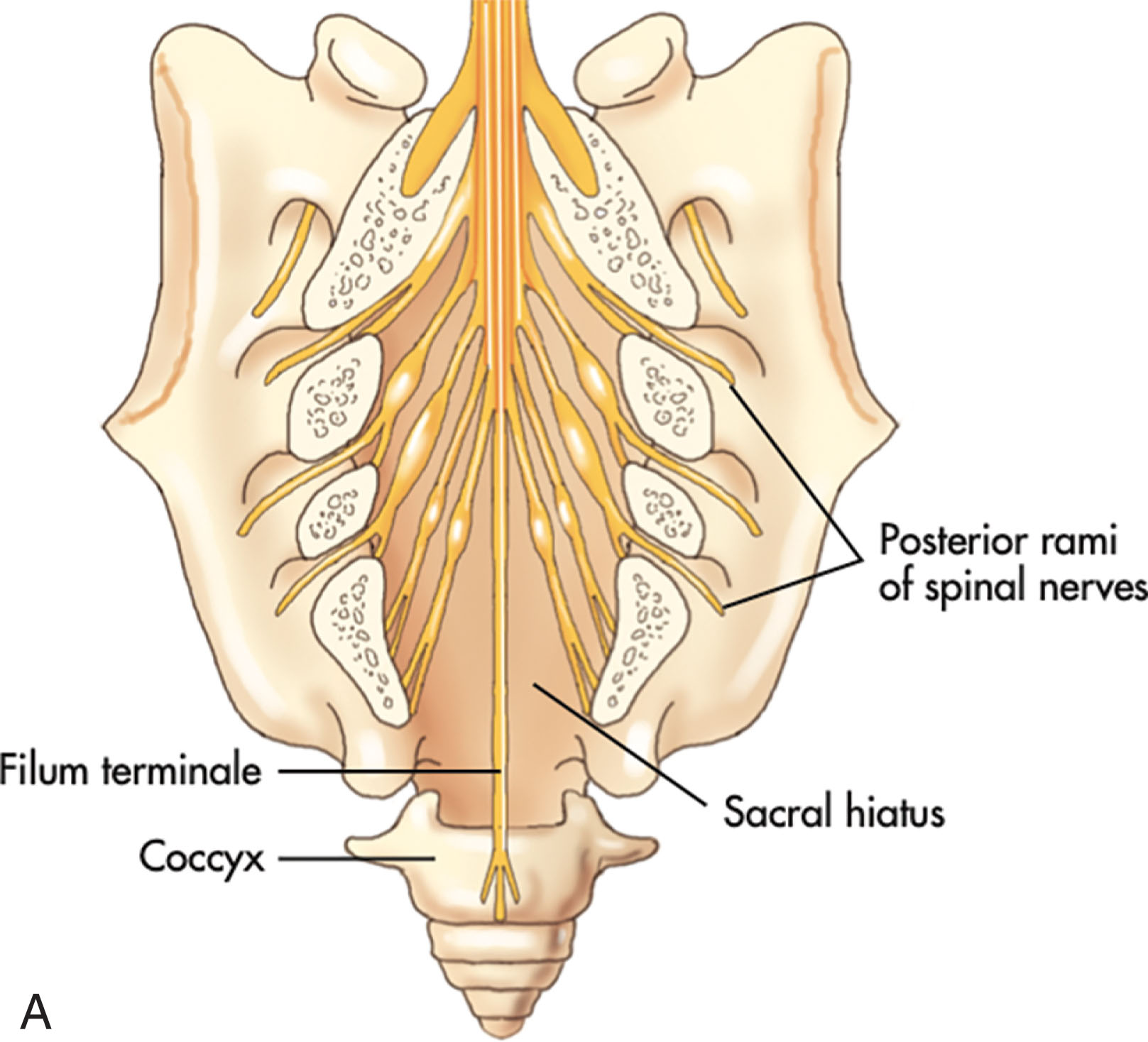 Fig. 29.5, Spinal cord (roots) and meninges.