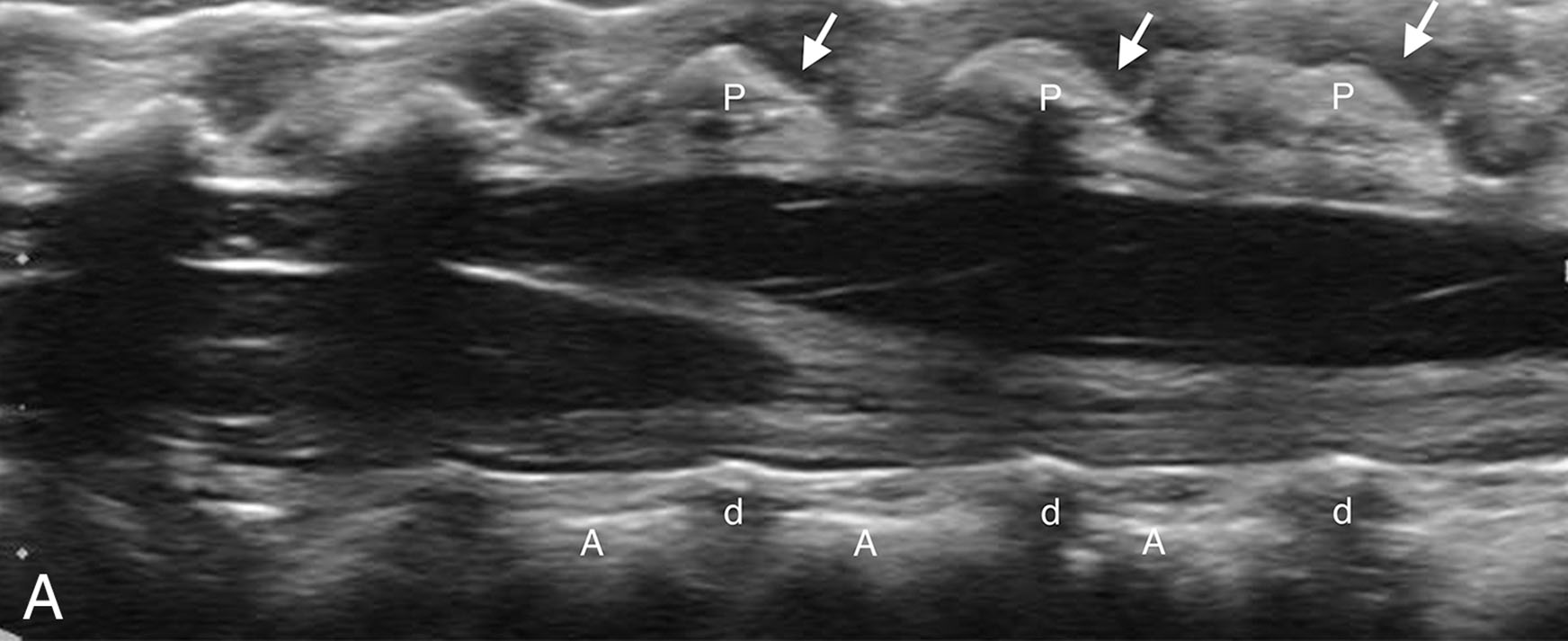 Fig. 29.6, Sagittal view of the normal thoracic/lumbar spine.