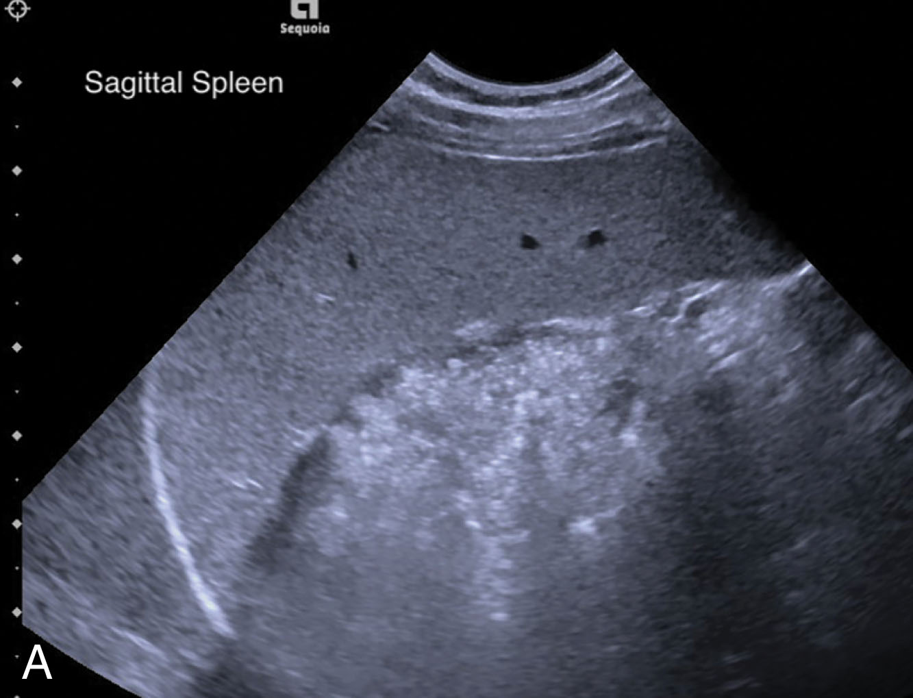Fig. 25.5, Normal pediatric and neonatal spleen.