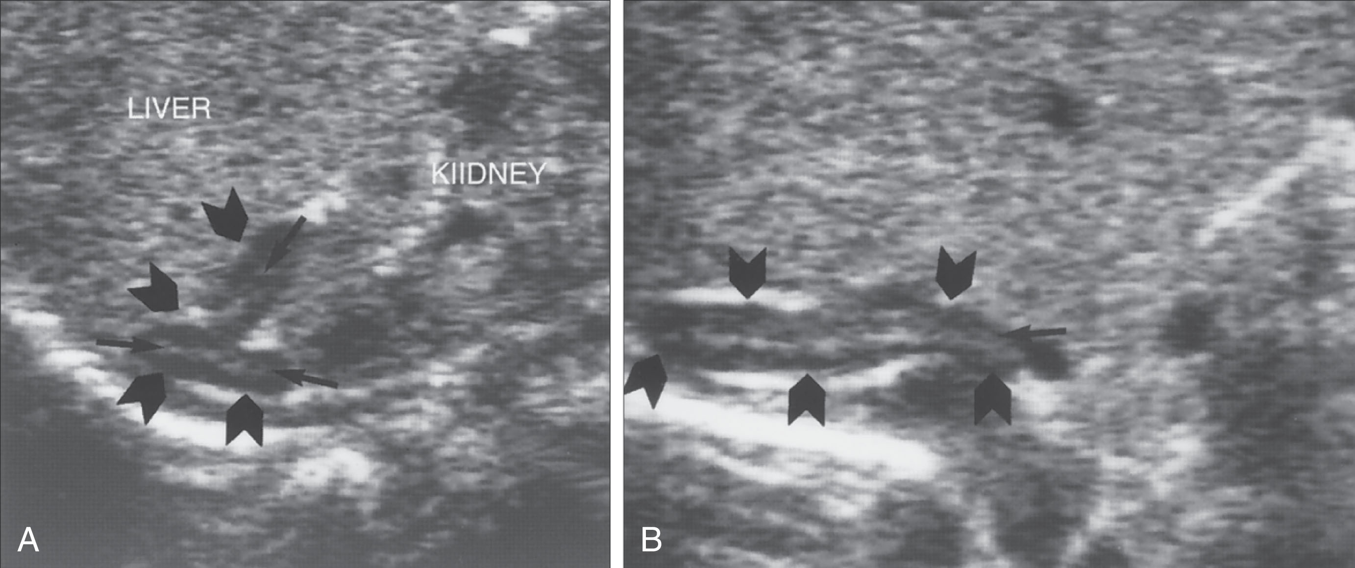 Fig. 26.5, Normal adrenal gland.