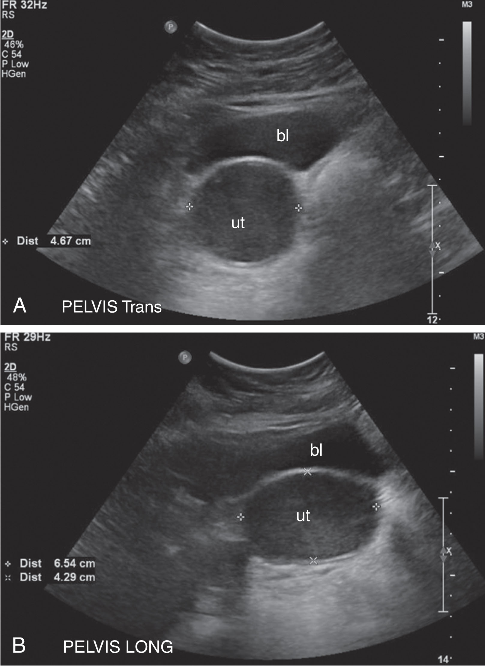 Fig. 26.8, Genitourinary pathology.