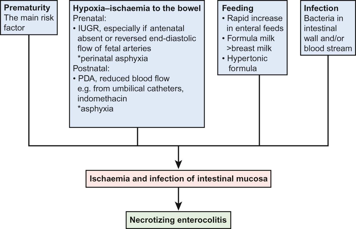 Fig. 11.4, Risk factors for the development of necrotizing enterocolitis.