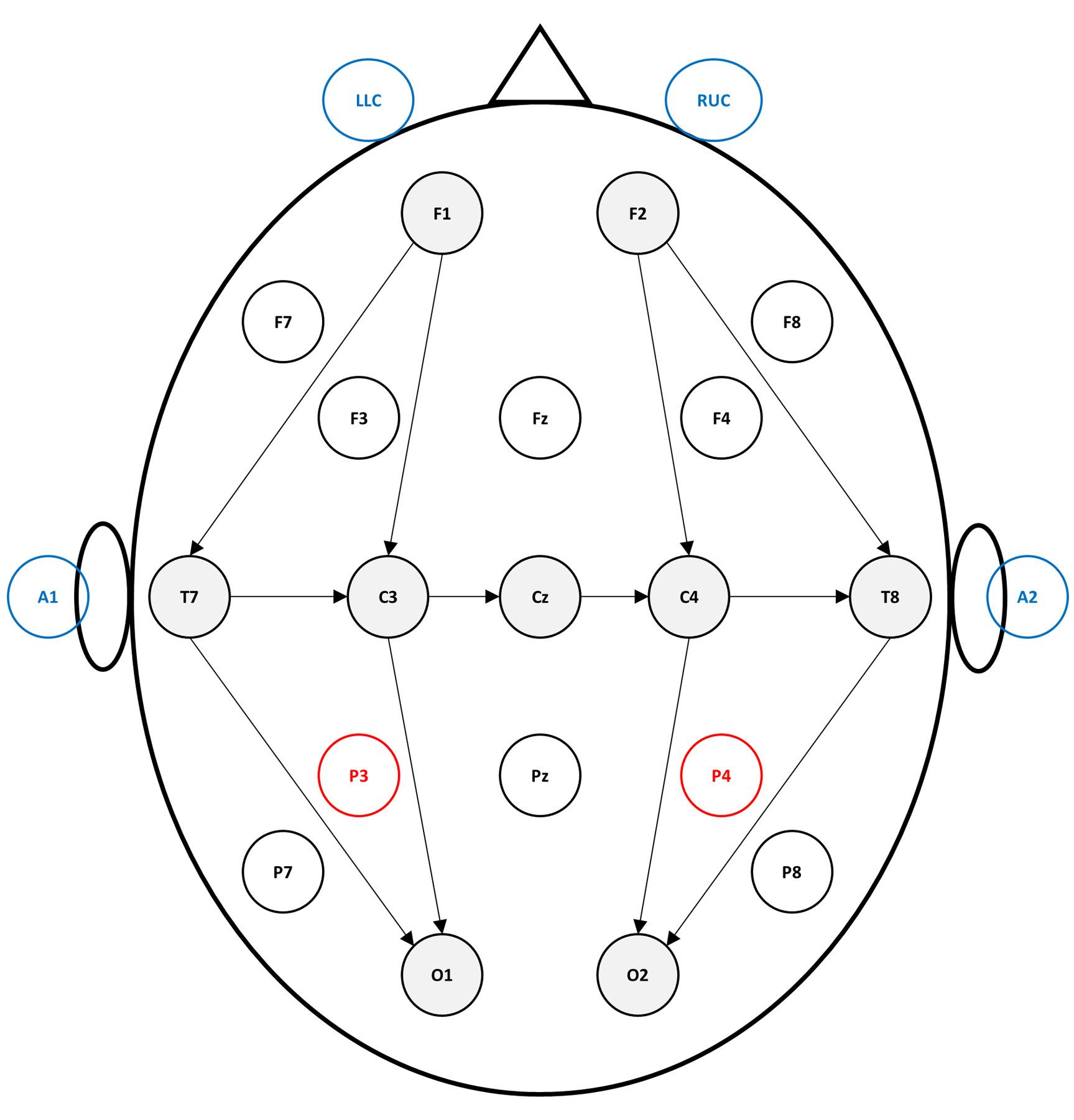 Fig. 19.2, The international 10 to 20 system for EEG electrode placement, modified for neonates. EEG electrodes are placed in the positions indicated. Odd numbers indicate the left side of the head, even numbers the right, and Z indicates the midline. Shaded electrodes are included in recordings of neonates. The parietal electrodes (checkered) represent the typical locations selected for amplitude-integrated EEG. Noncerebral electrodes (speckled) to record eye movements (left lower canthus, LLC, and right upper canthus, RUC ) and as reference electrodes placed on the ears (A1 and A2) are also shown. Not shown, a respiratory channel and single-channel electrocardiogram are required for accurate interpretation of the study.