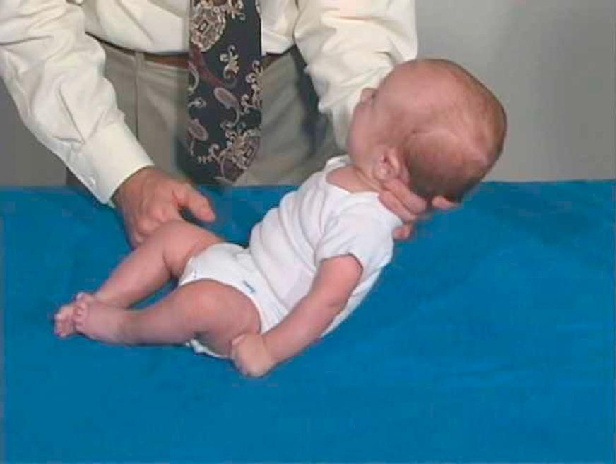 Fig. 2.15, Moro reflex. To elicit the reflex, hold the head and shoulders and quickly allow them to drop a few inches without the infant reaching the exam surface.