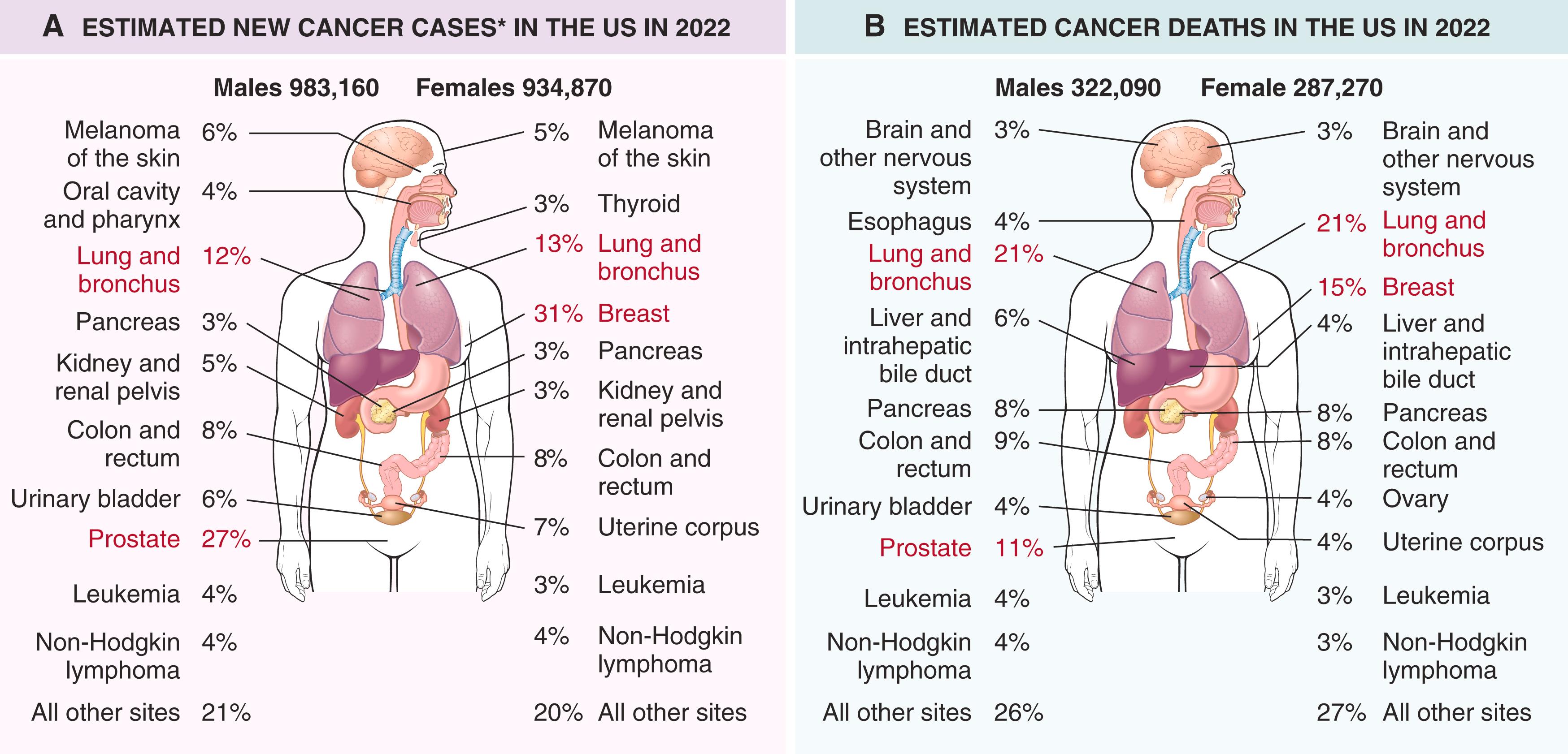 FIG. 6.11, Estimated cancer incidence (A) and mortality (B) by site and sex in the United States. Excludes basal cell and squamous cell skin cancers and in situ carcinomas, except urinary bladder. The most common tumors are denoted by red text.