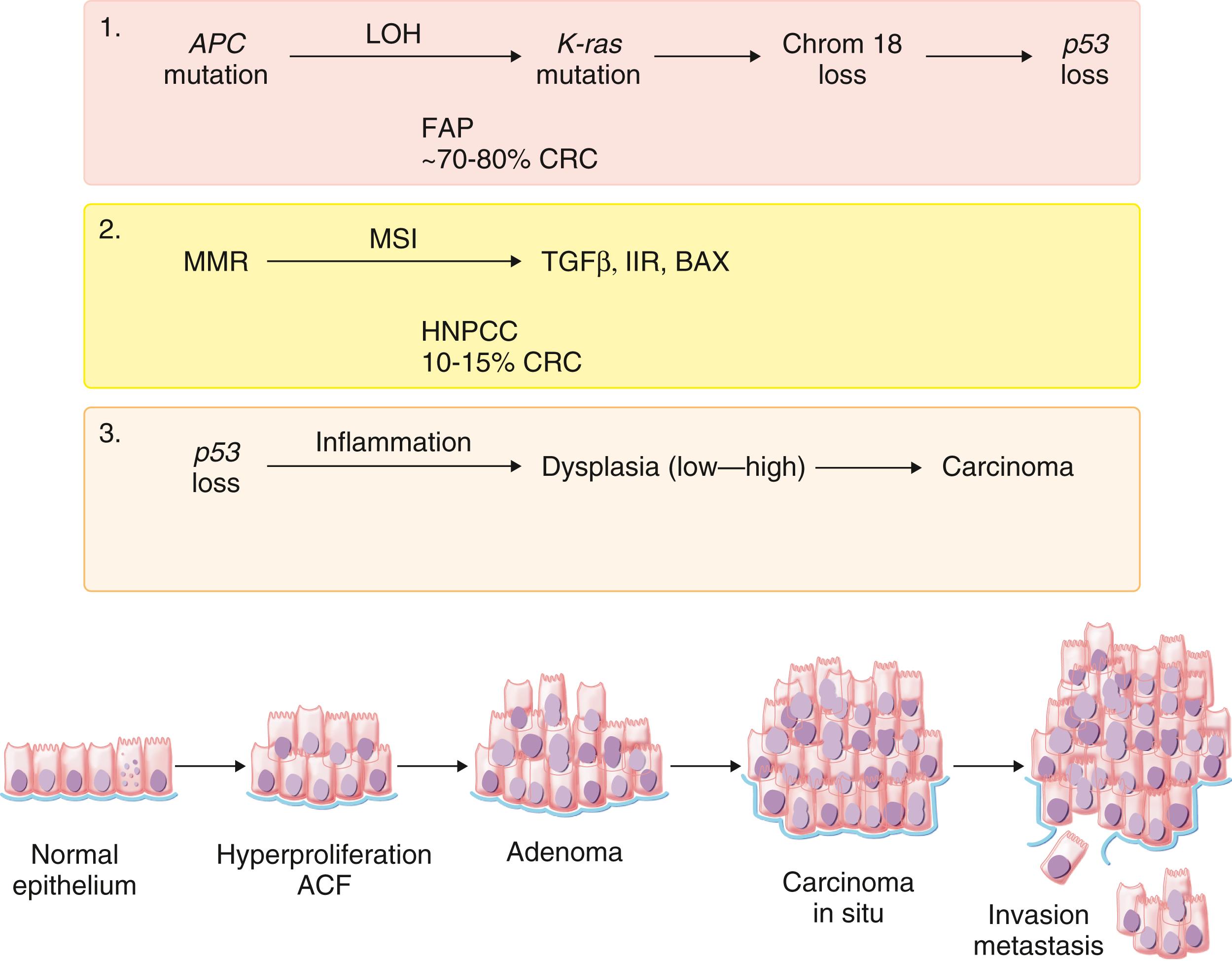 FIGURE 179-3, The molecular basis of colorectal cancer.