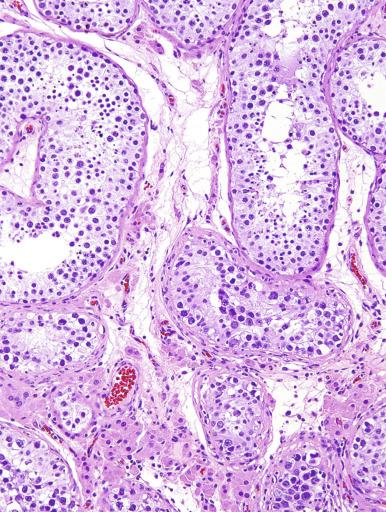 Fig. 13.6, Patchy distribution of GCNIS.