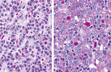 Fig. 28-6, Staining for colloid.