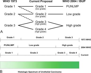 Fig. 6.29, Comparisons of different grading systems.