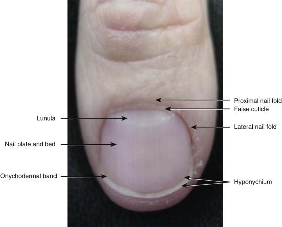 FIGURE 18-1, Normal nail unit.