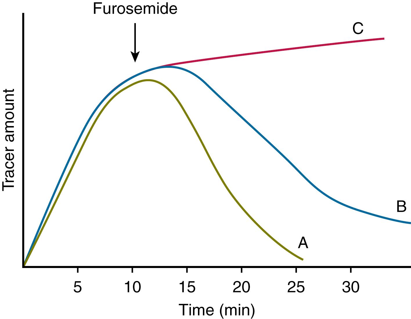 Fig. 20.3, MAG3 scan image showing expected appearances for normal kidney (A), partially obstructed kidney (B) and bladder (C).