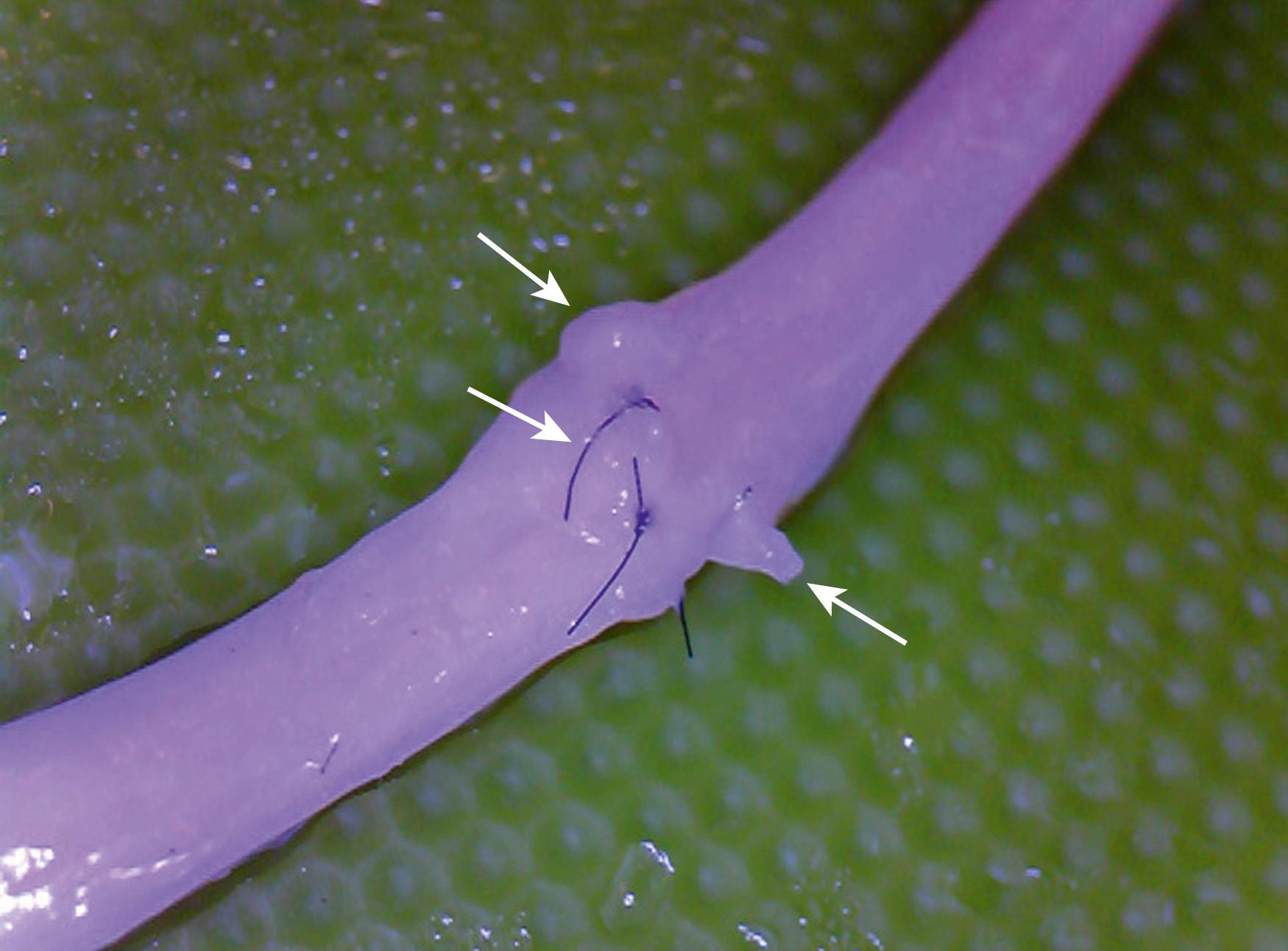 Fig. 30.9, Cadaver nerve repair demonstrating poor alignment. Arrows pointing to fascicles sticking out through coaptation.