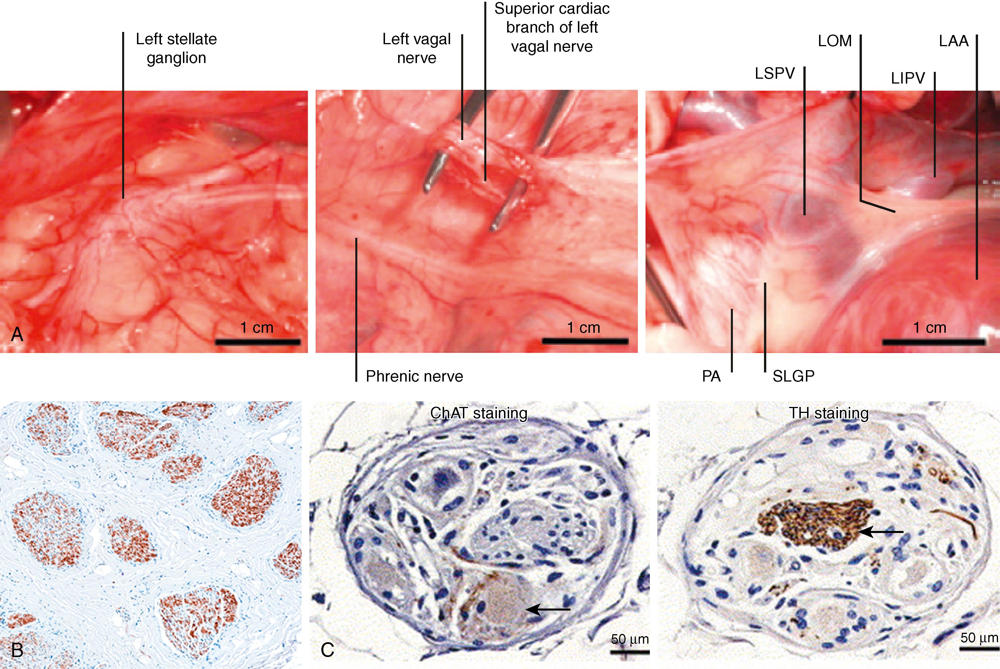 Fig. 40.2, Anatomy and histology of cardiac autonomic nervous system.