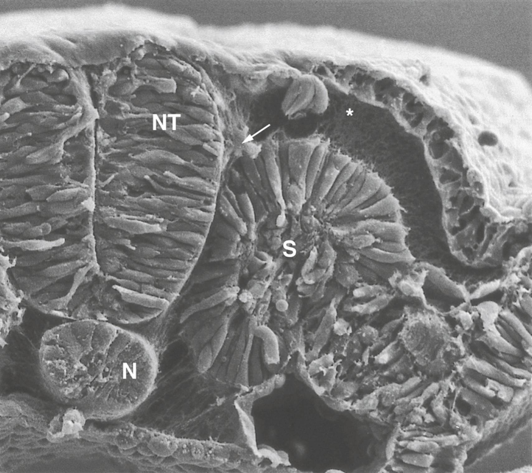 Fig. 12.2, Scanning electron micrograph of a chick embryo, showing the early migration of neural crest cells ( arrow ) out of the neural tube (NT).