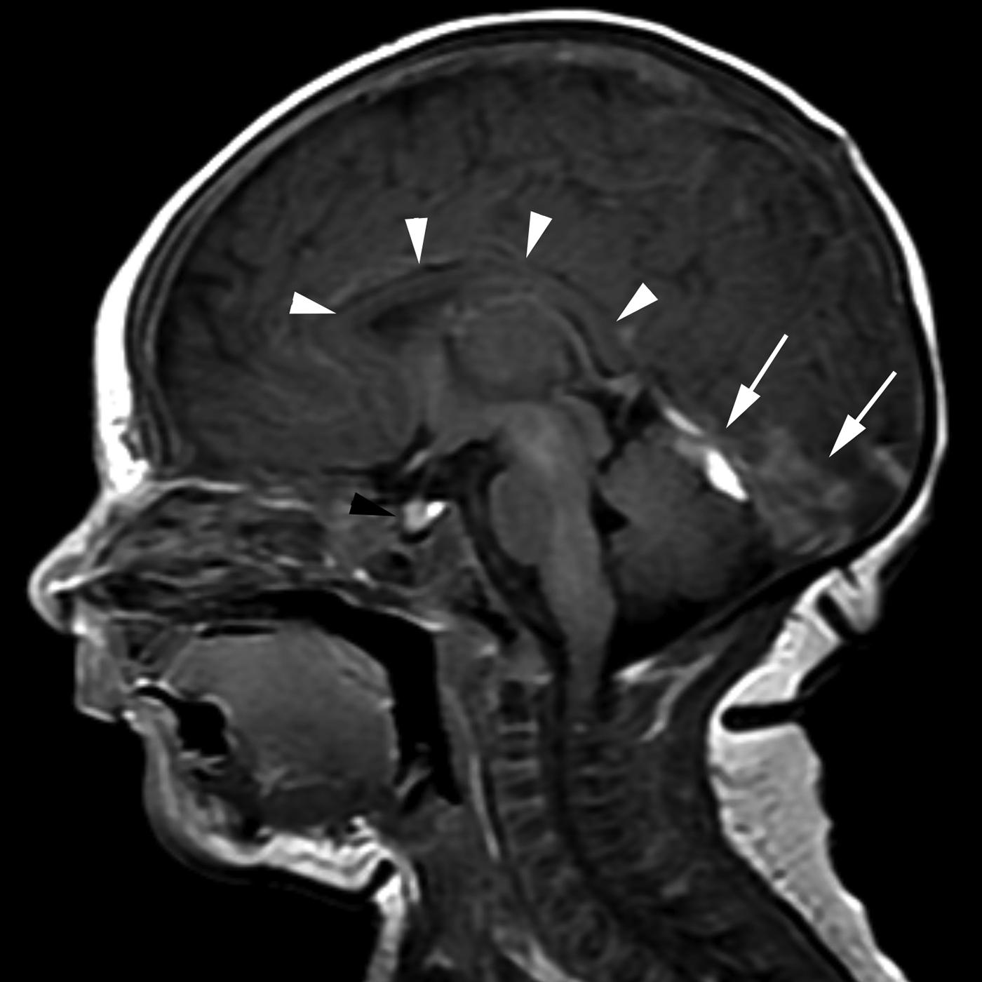 Figure 8-19, Normal neonate.