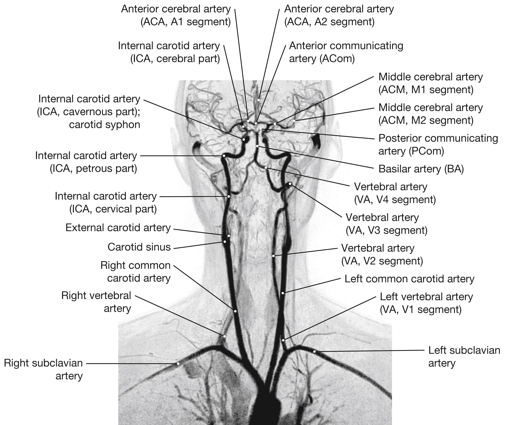 Fig. 12.15, Magnetic resonance (MR) angiogram of the arterial supply to the brain.